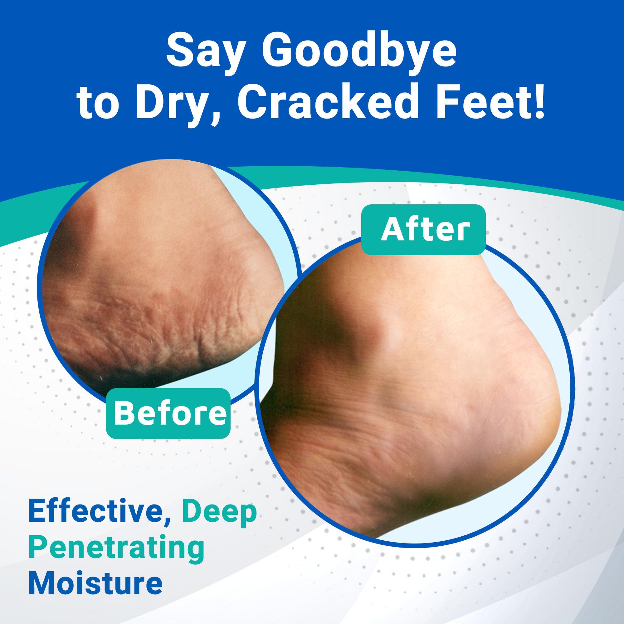 Dermal Therapy Heel Care Cream – Intensive Foot Moisturizer with Urea & AHAs | Non-Greasy