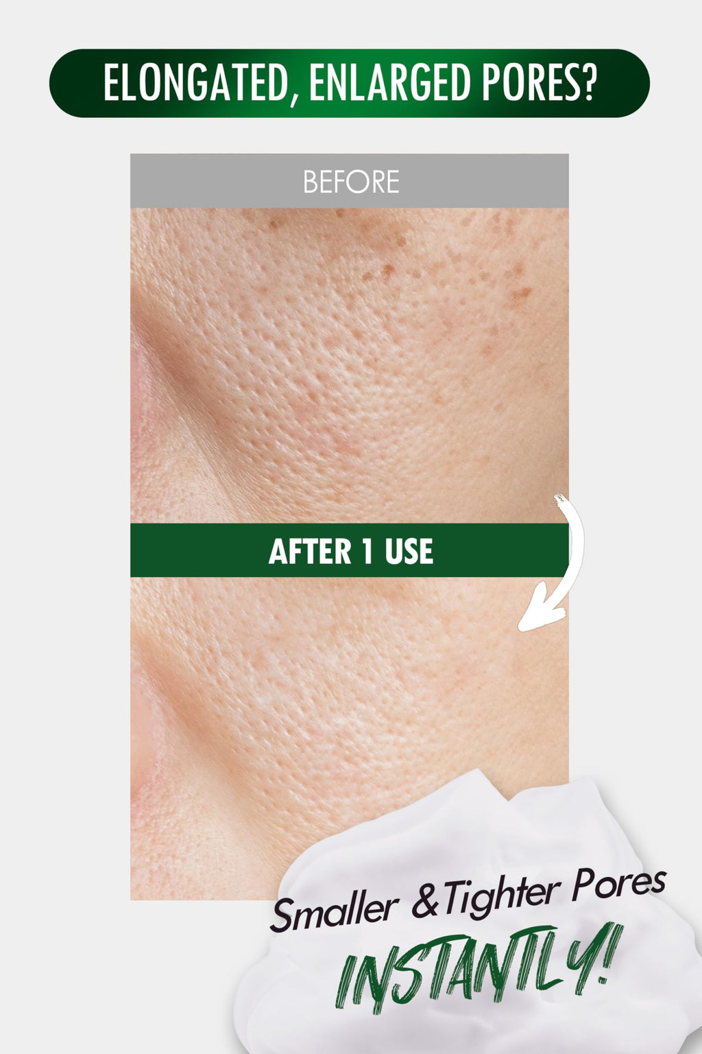 DERMALOGY by NEOGENLAB Pore Zero Peeling Mousse | Foaming Exfoliator for Firming