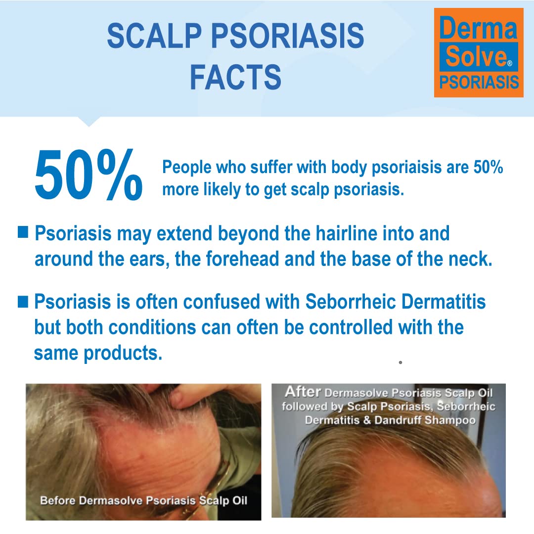 Dermasolve Medicated Scalp Shampoo & Conditioner for Psoriasis & Dandruff