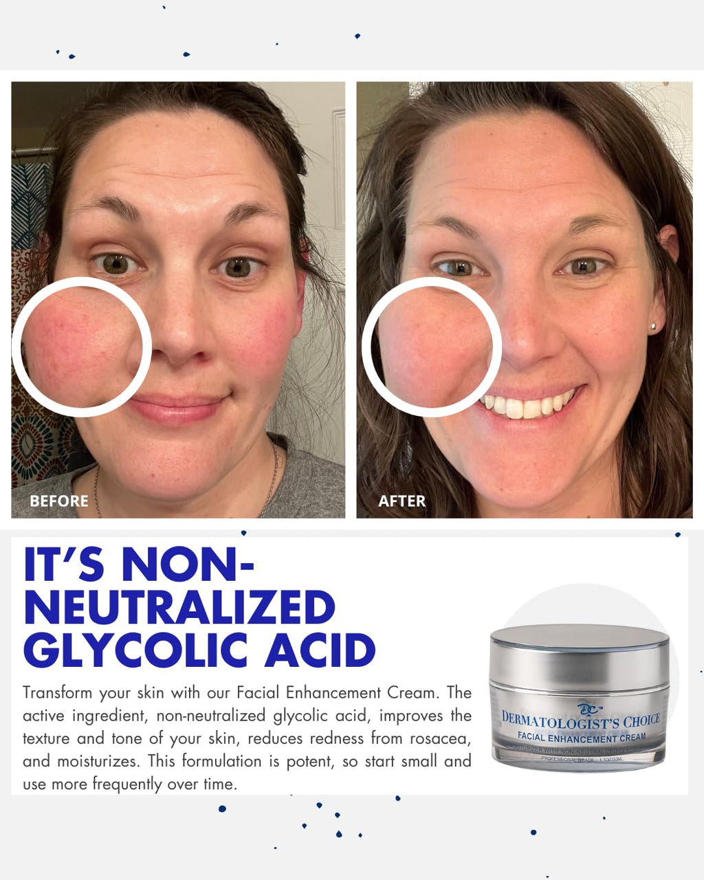 Dermatologist's Choice Daily Anti-Aging Facial Enhancement Cream With Non-Neutralized Glycolic Acid, Vitamin C, and Superoxide Dismutase