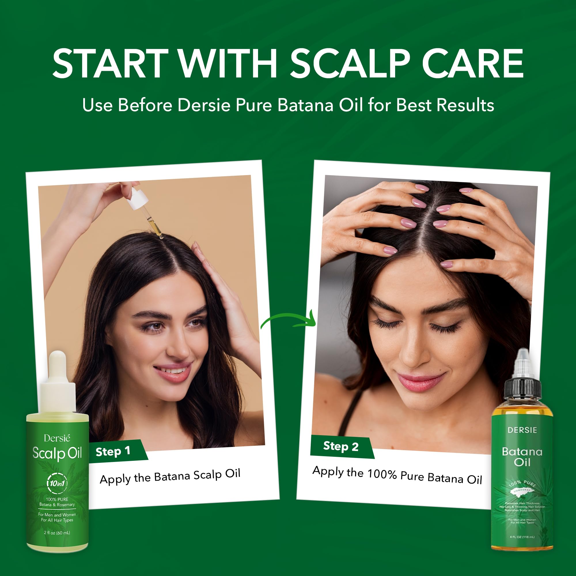 Dersie Scalp Oil for Hair Loss & Thinning Hair – Batana, Rosemary & Tea Tree (60mL)