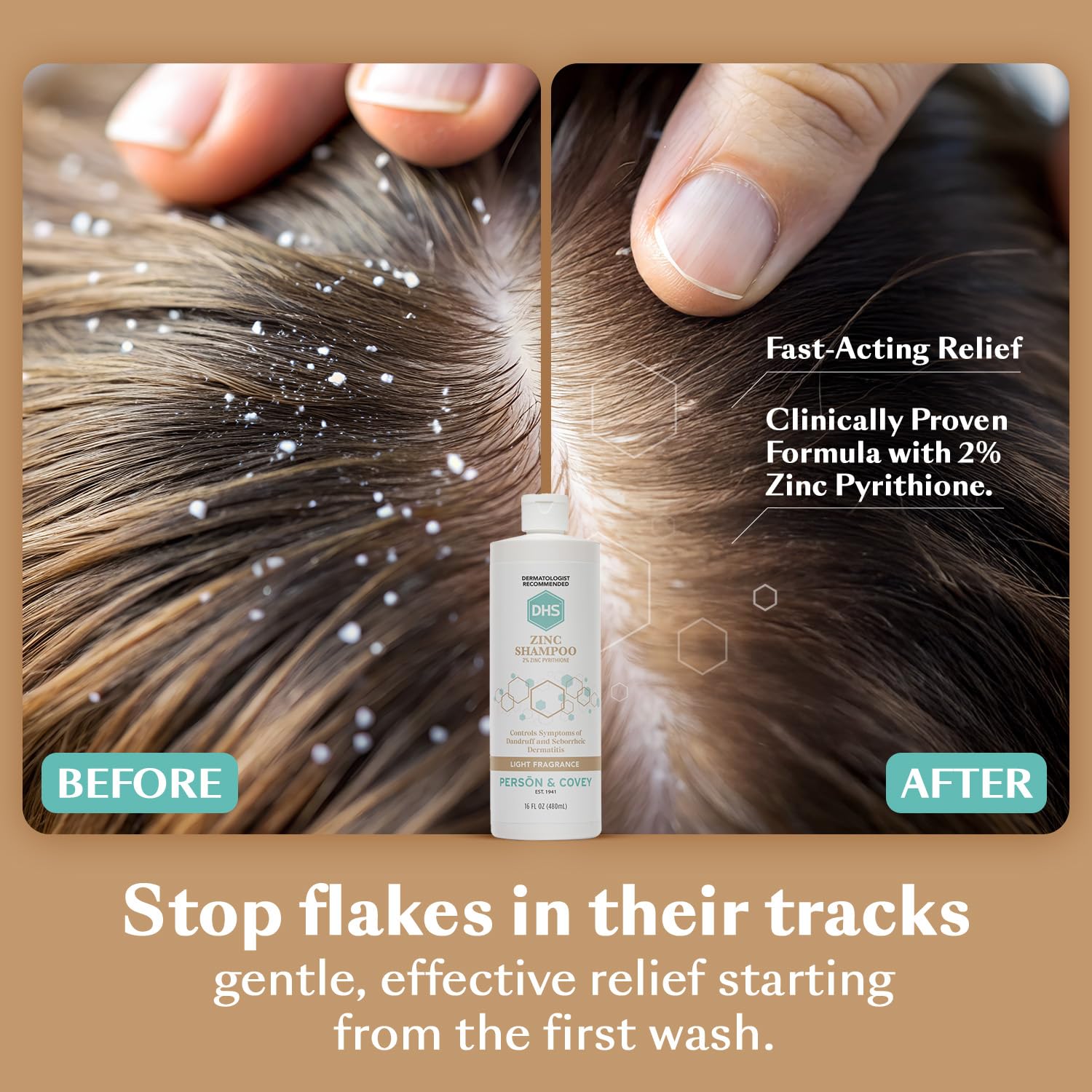 DHS Zinc Shampoo – 16 Oz (Pack of 2) | Detangling, Shine & Panthenol