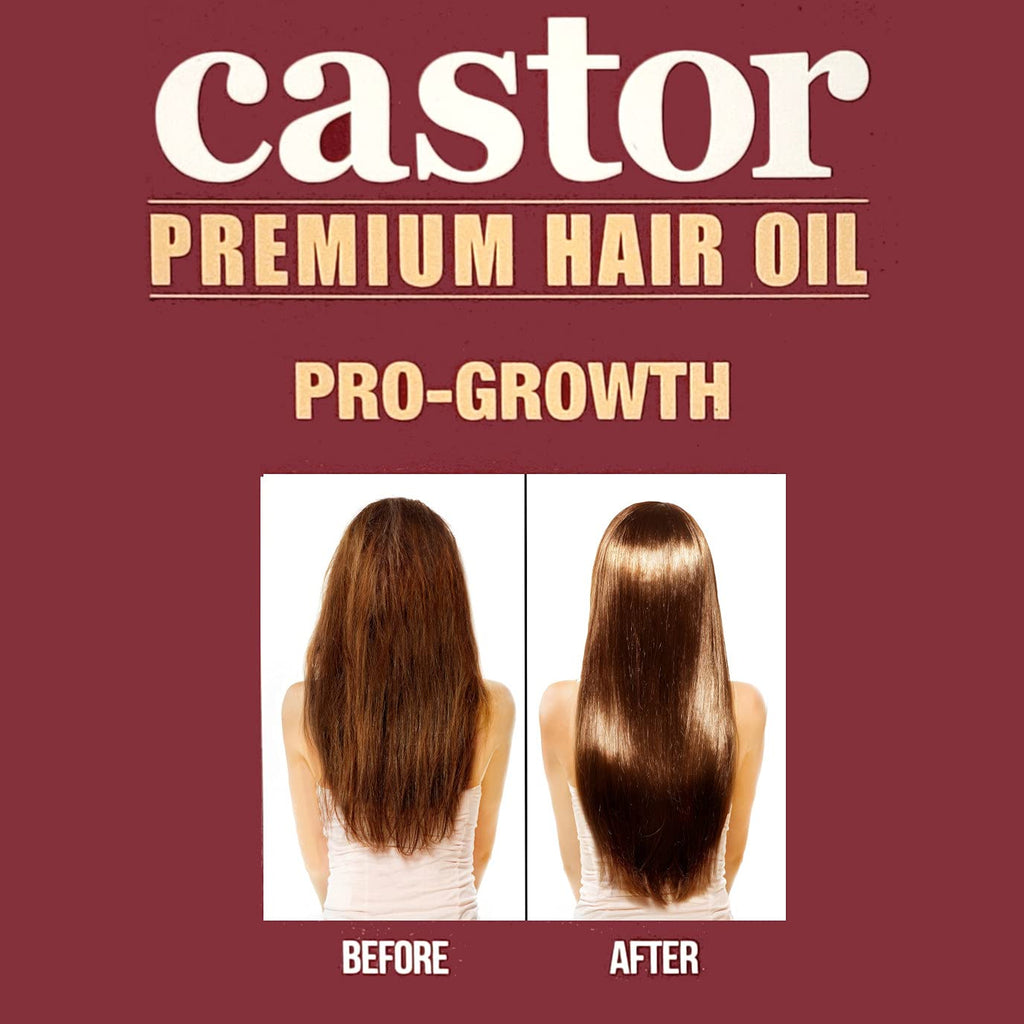 Difeel Pro-Growth Hair Care Set with Castor Oil – 3-Piece Shampoo, Conditioner & Hair Oil (Made in USA)