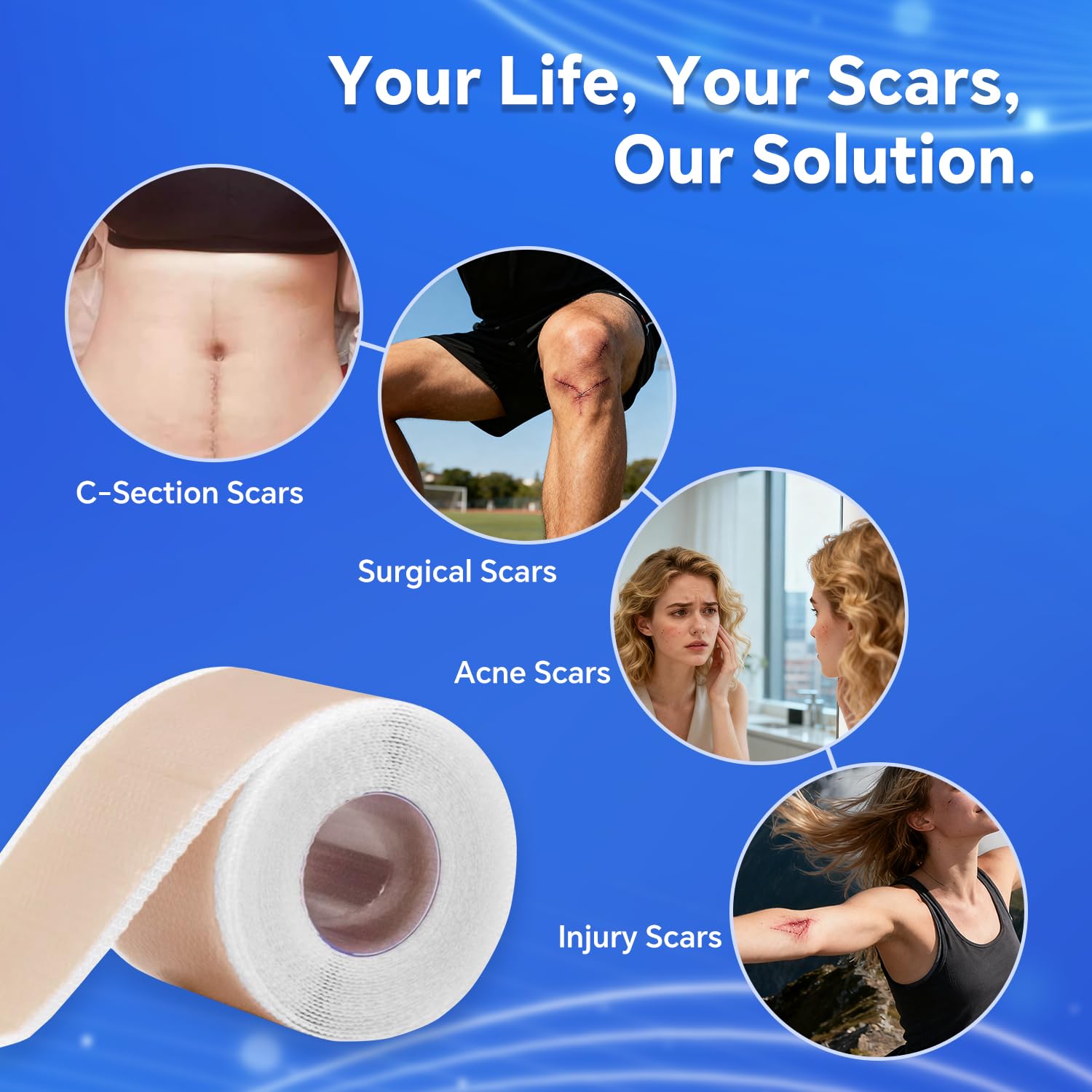 Discoliner Silicone Scar Sheets – Reusable Scar Tape (3M) for Surgical, C-Section, Acne & Burn Scars