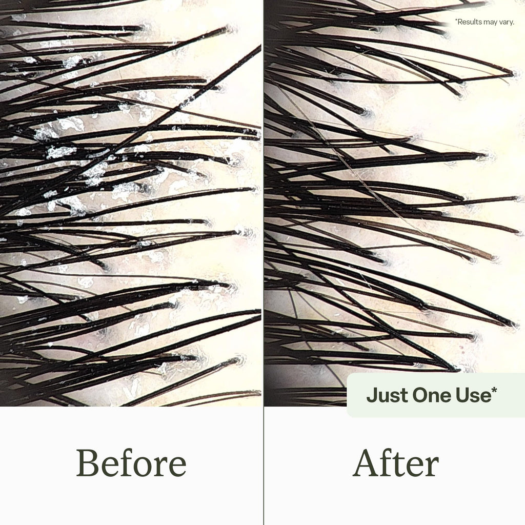 Divi Clarifying Scalp Reset Shampoo | Weekly Deep Cleansing for Buildup & Hard Water