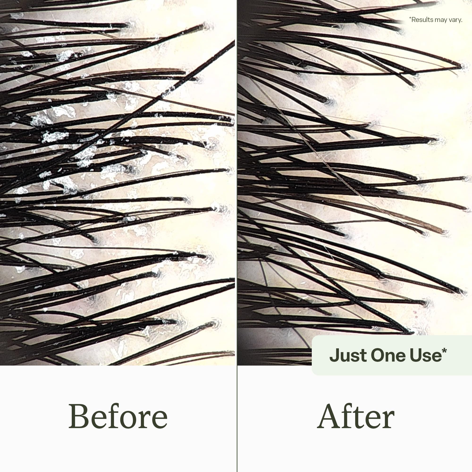 Divi Clarifying Scalp Reset Shampoo | Weekly Deep Cleansing for Buildup & Hard Water