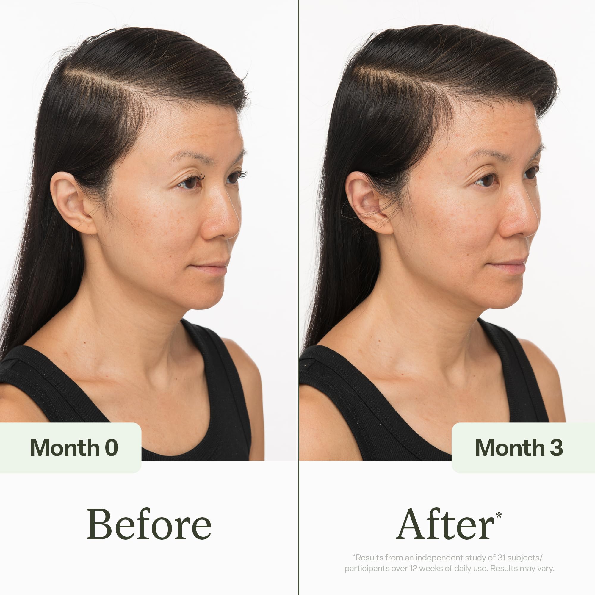 Divi Scalp Serum for Thinning Hair, 15ml – Clinically Tested Nourishing Formula with Amino Acids, Caffeine & Rosemary Oil