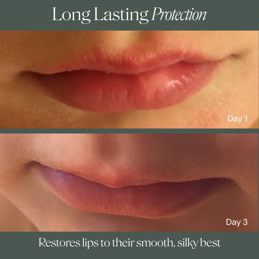 Doctor Rogers Lip Balm | Hydrating & Softening Lip Moisturizer for Very Dry Lips (0.15 oz)