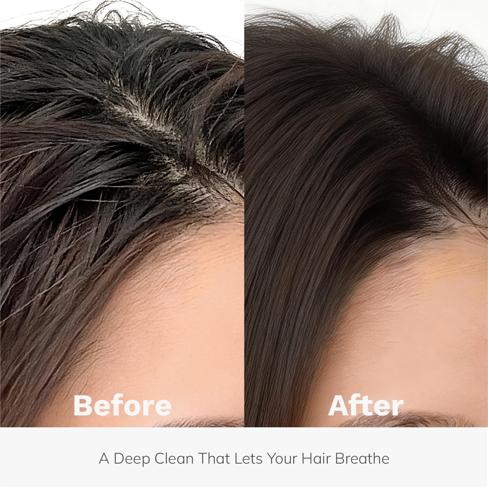 DORPANG Restore Shampoo for Thinning Hair – AnaGain™ Peptide Formula | Sulfate-Free 12oz