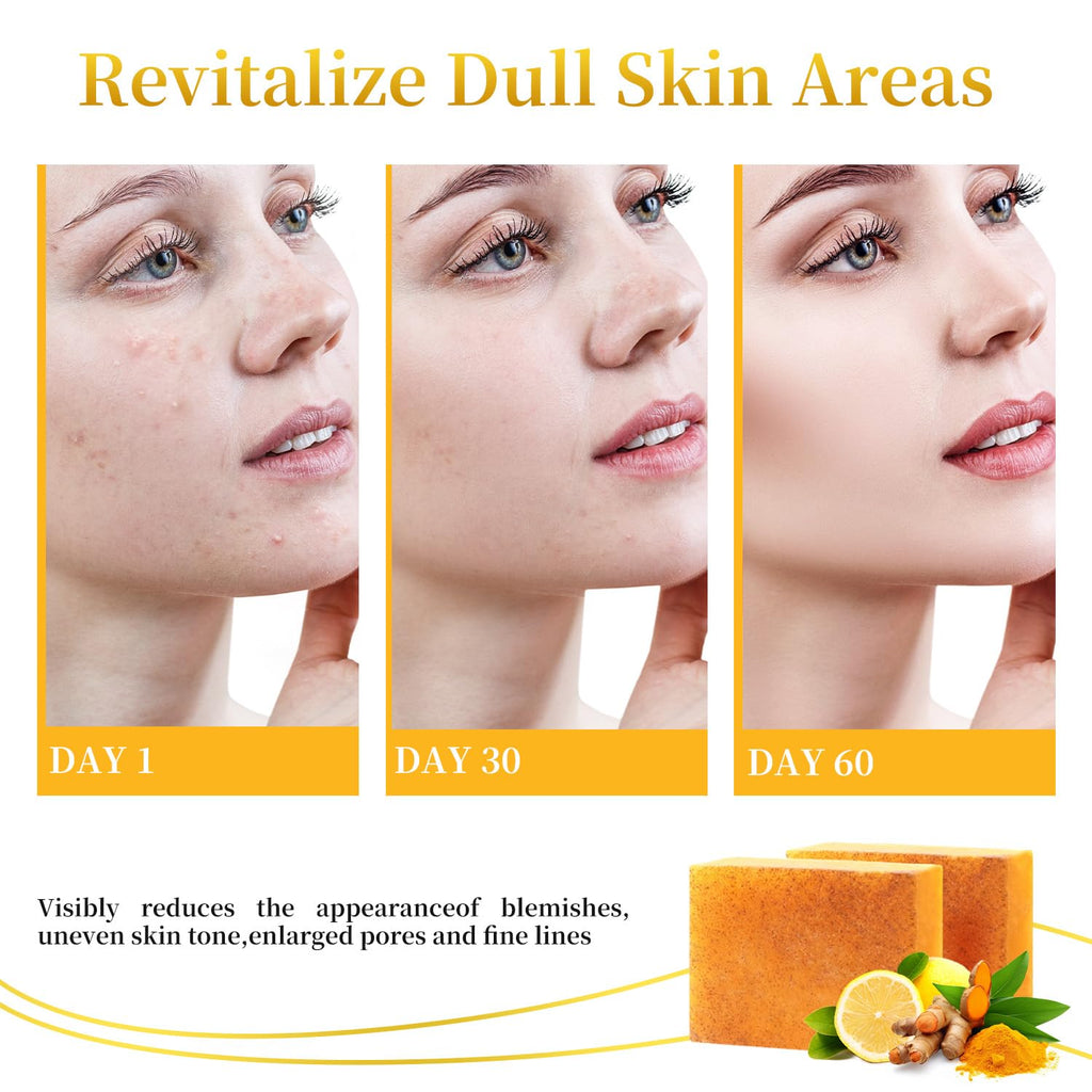 DOXOLATO Lemon Turmeric Soap Bars for Face & Body – 4 Bars + Net Sponge