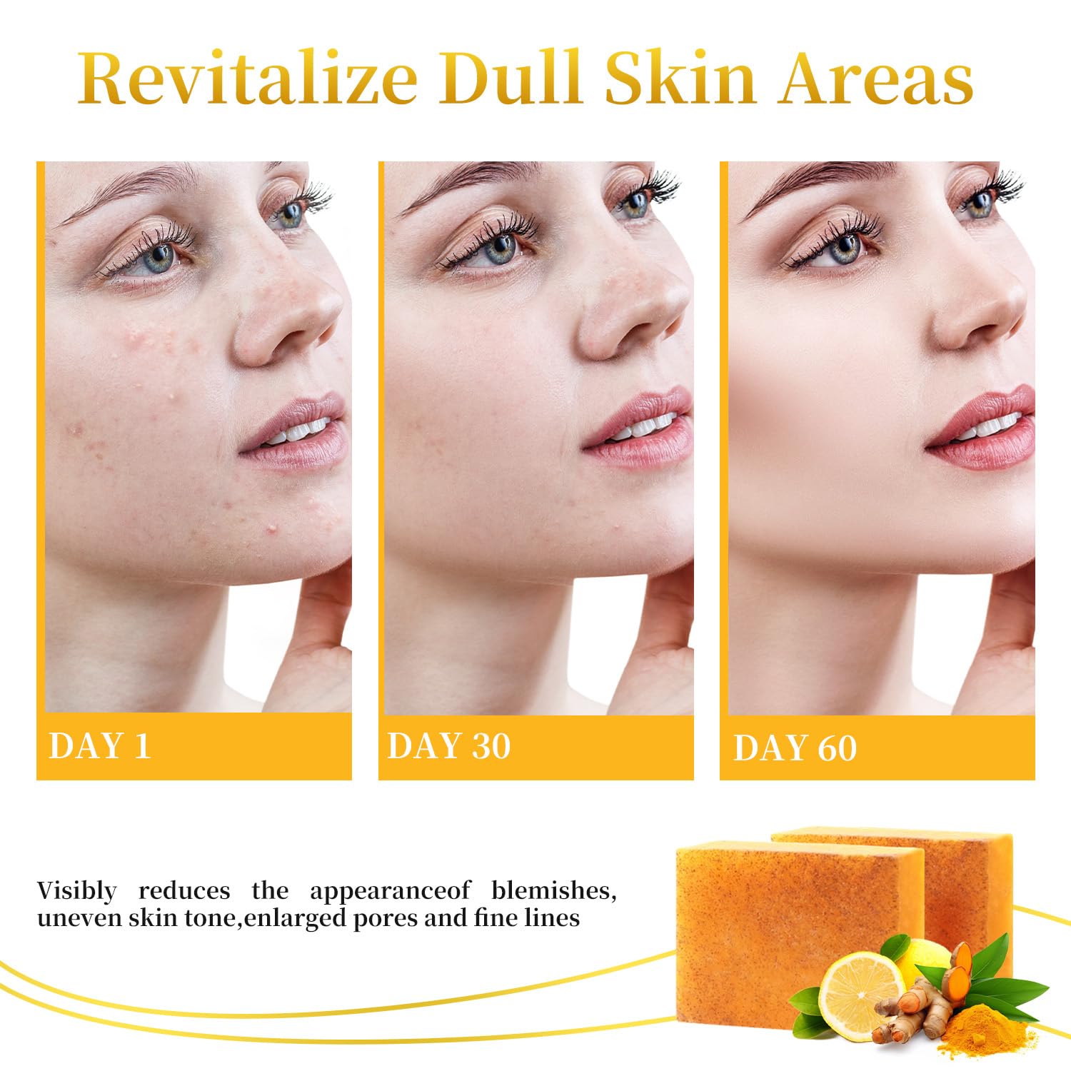 DOXOLATO Lemon Turmeric Soap Bars for Face & Body – 4 Bars + Net Sponge