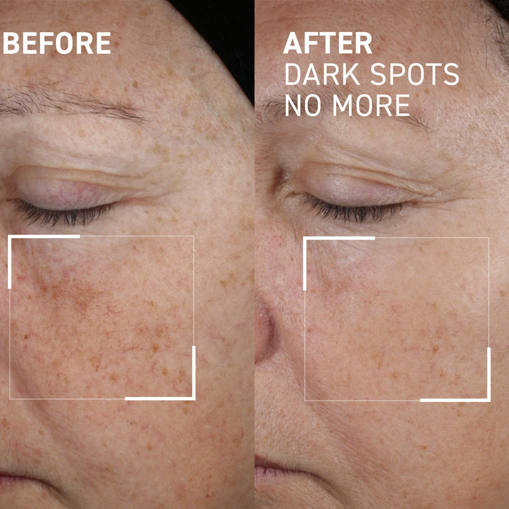 Dr. Brandt Bright This Way Dark Spots No More – 0.5 Fl Oz Pack of 2 | Target Hyperpigmentation
