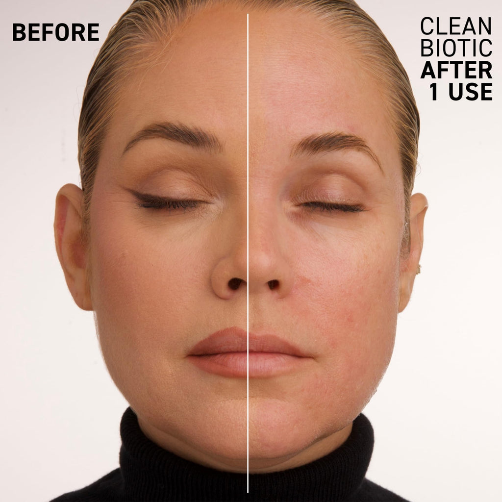 Dr. Brandt Skincare Clean Biotic Yogurt Cleanser – pH-Balanced, 3.5 oz