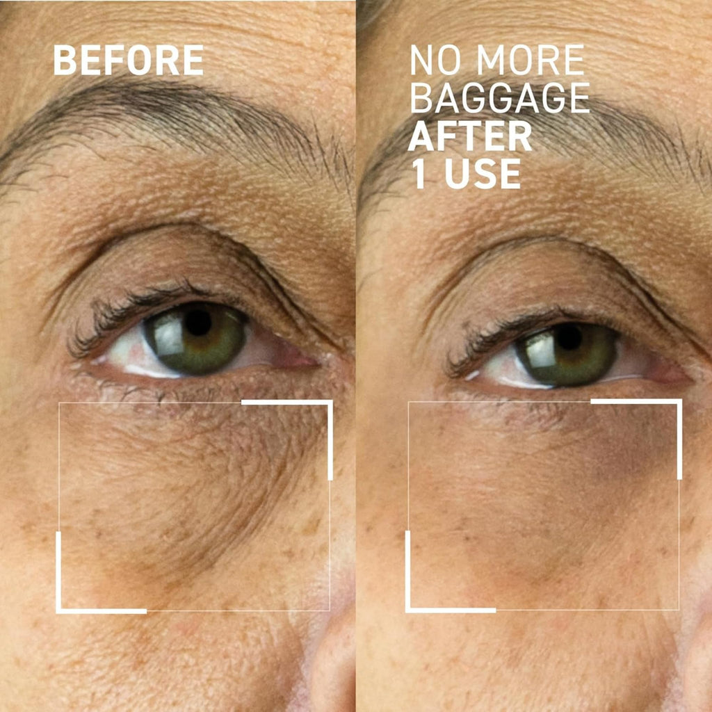 Dr. Brandt Skincare Needles No More Baggage Bundle - Minimizes Under-Eye Bags, Puffiness & Dark Circles (Full 0.5 oz + Travel 0.25 oz)