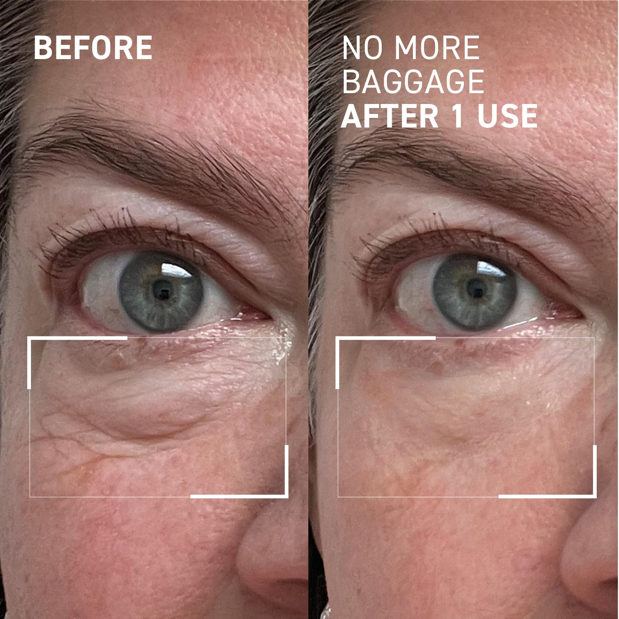 Dr. Brandt Needles No More Baggage – 0.5 oz x2 Eye Gel Minimizes Puffiness & Dark Circles