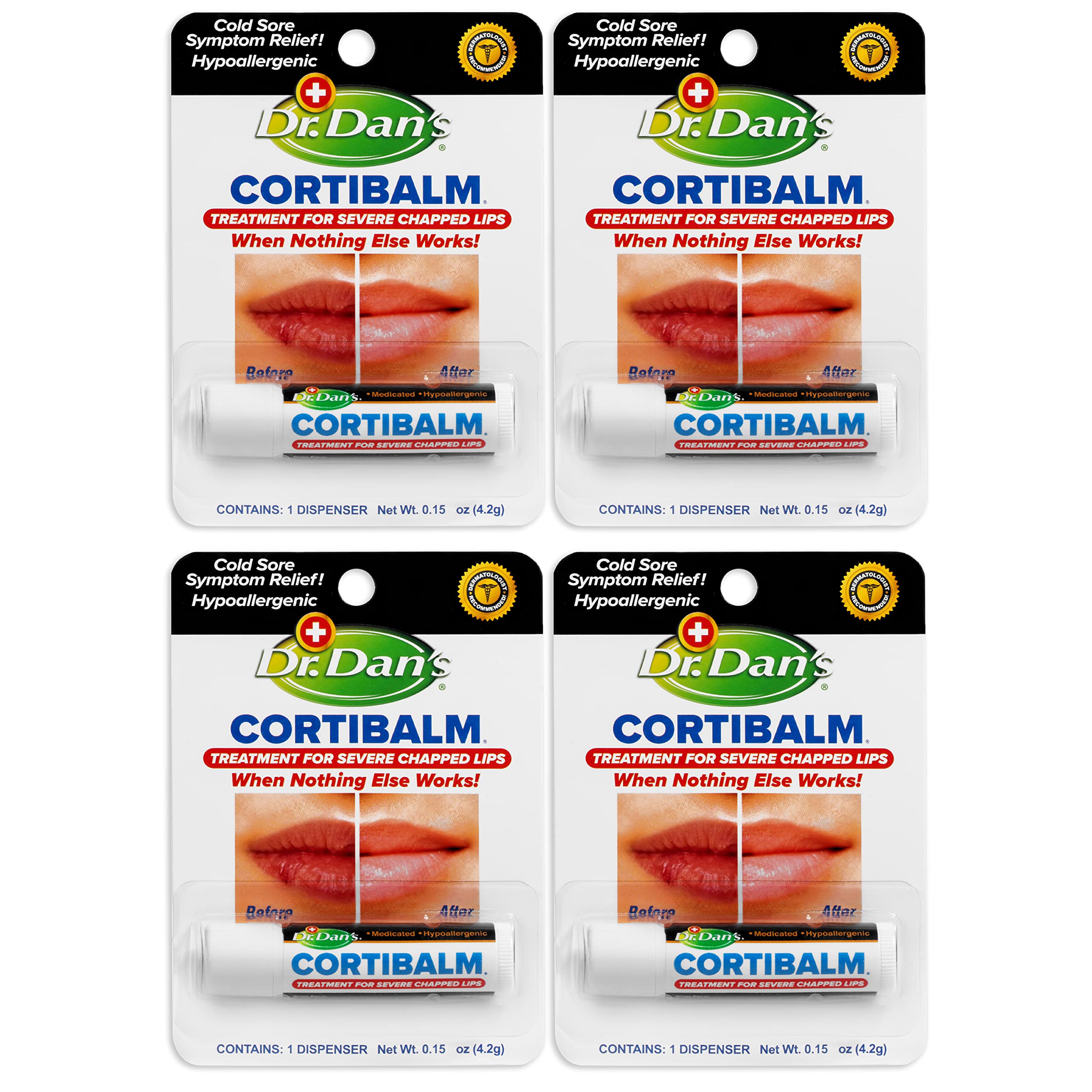 Dr. Dan's Cortibalm 4 Pack – Lip Balm for Severe Chapped Lips (1% Hydrocortisone), Gentle & Hypoallergenic