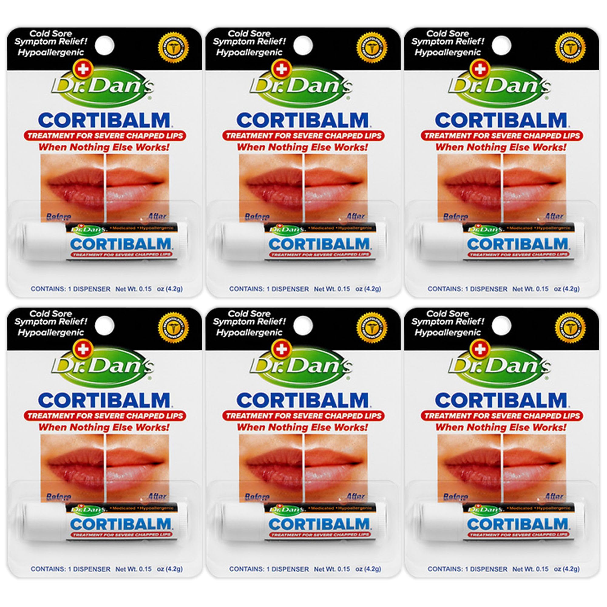Dr. Dan's Cortibalm 6-Pack – Healing Lip Balm for Severely Chapped Lips