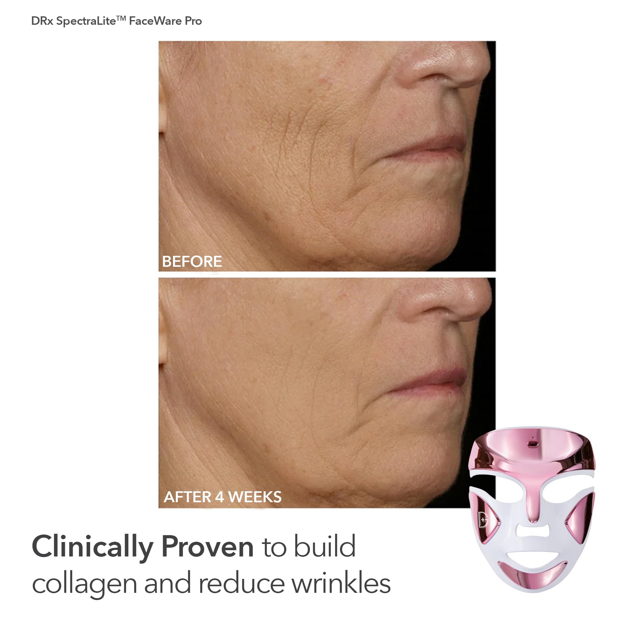 Dr Dennis Gross dpl FaceWare Pro Pink LED Mask Gift Set – Collagen, Brightening & Firming with Cleansing Oil, Dewy Deep Cream & 5 Universal Daily Peels | $592 Value