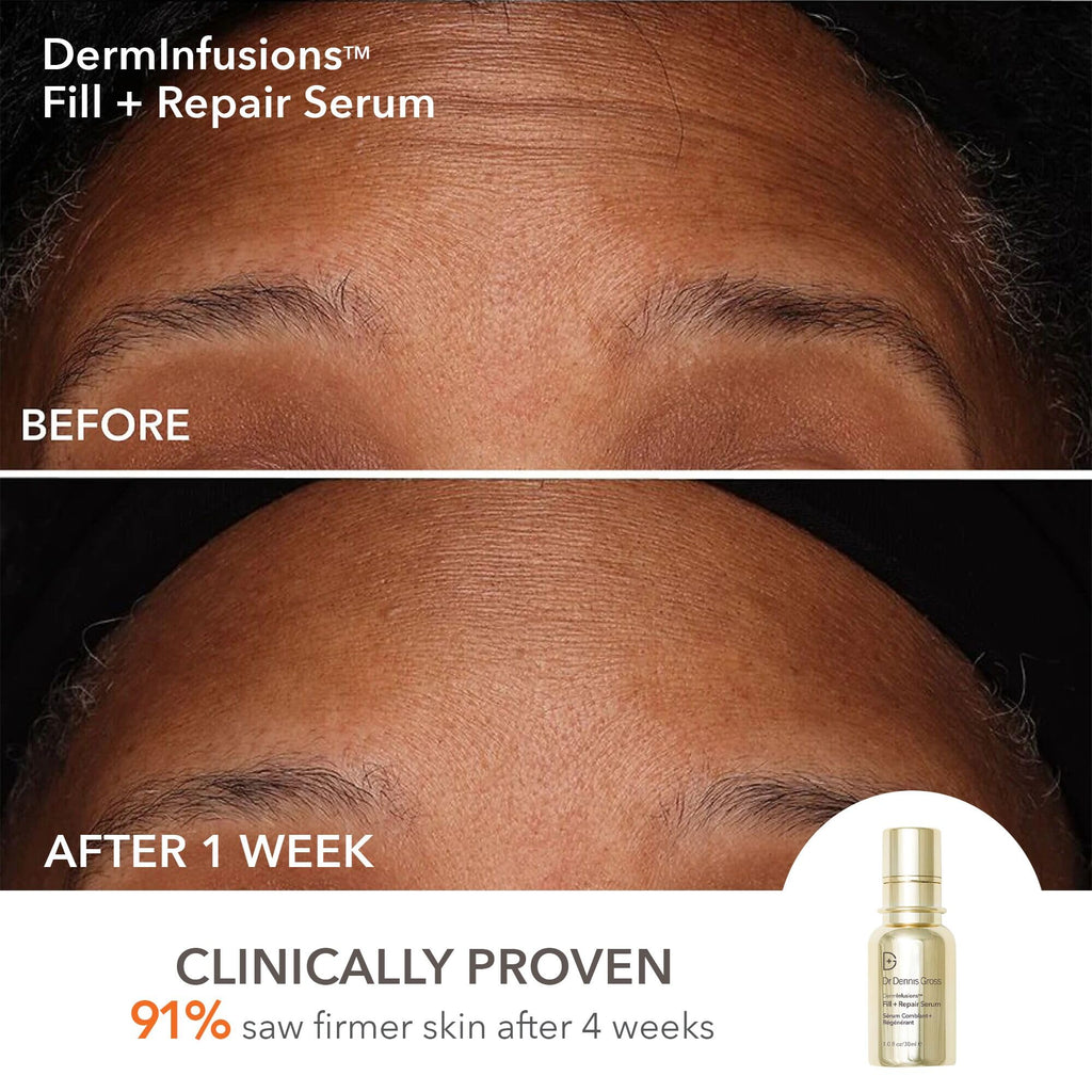 Dr Dennis Gross DermInfusions Discovery Kit — Plump, Fill & Repair Skincare Set