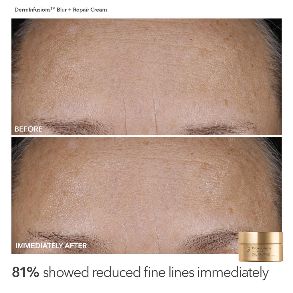 Dr Dennis Gross Plump & Smooth Limited Edition Kit | Blur + Repair Cream + 5 Alpha Beta Universal Daily Peels