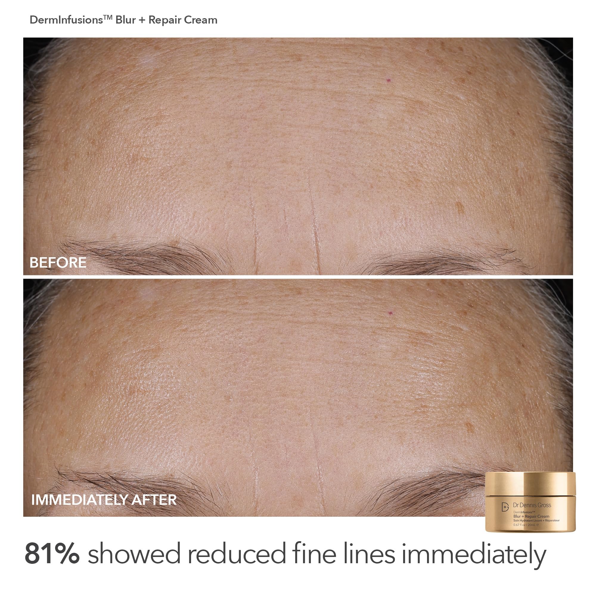 Dr Dennis Gross Plump & Smooth Limited Edition Kit | Blur + Repair Cream + 5 Alpha Beta Universal Daily Peels