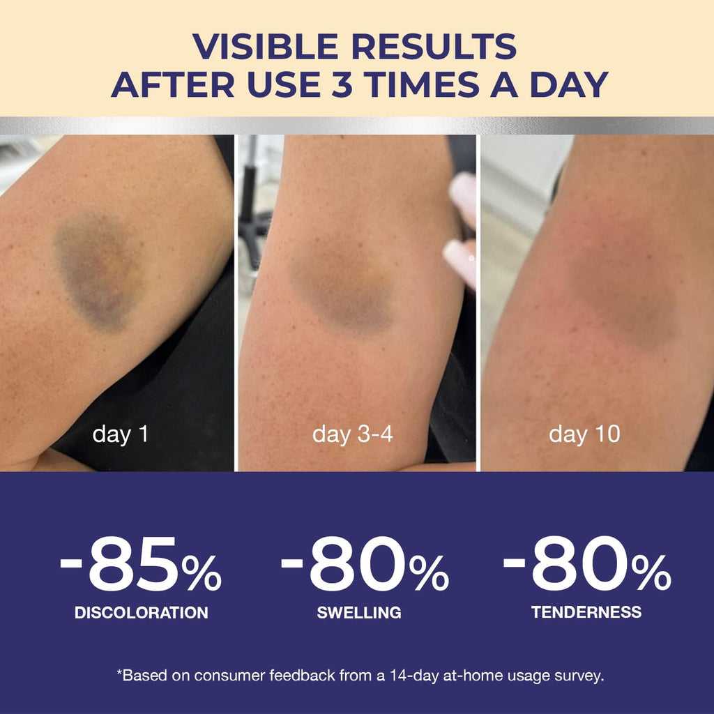 Dr. Luke Arnica Bruise Cream Extra Strength – Fast Relief for Bruising, Swelling & Discoloration