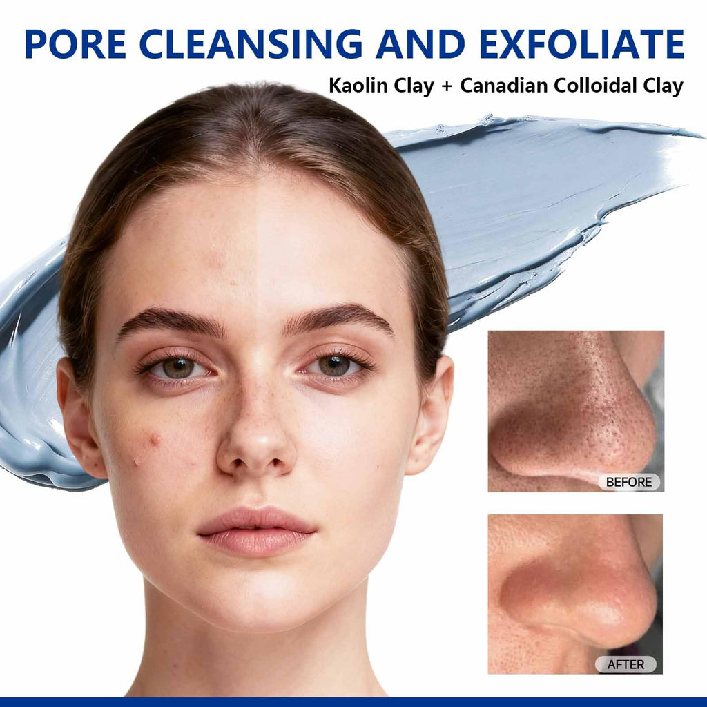 Dr Vincent Deep Pore Cleansing Blue Clay Mask for Face – 5.3 oz Large with Niacinamide