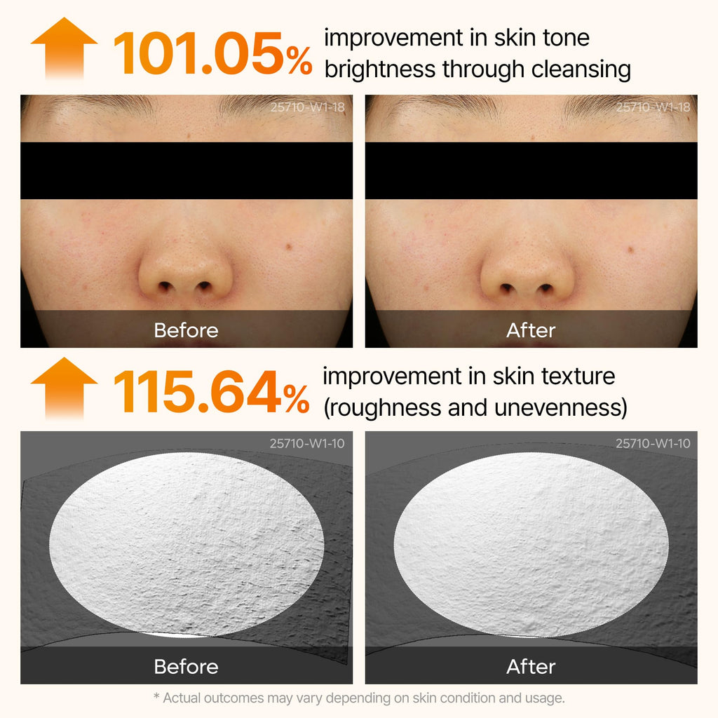 Dr.Melaxin Peel Shot Kojic Acid Turmeric Serum 80ml | Dark Spot Care & Exfoliation