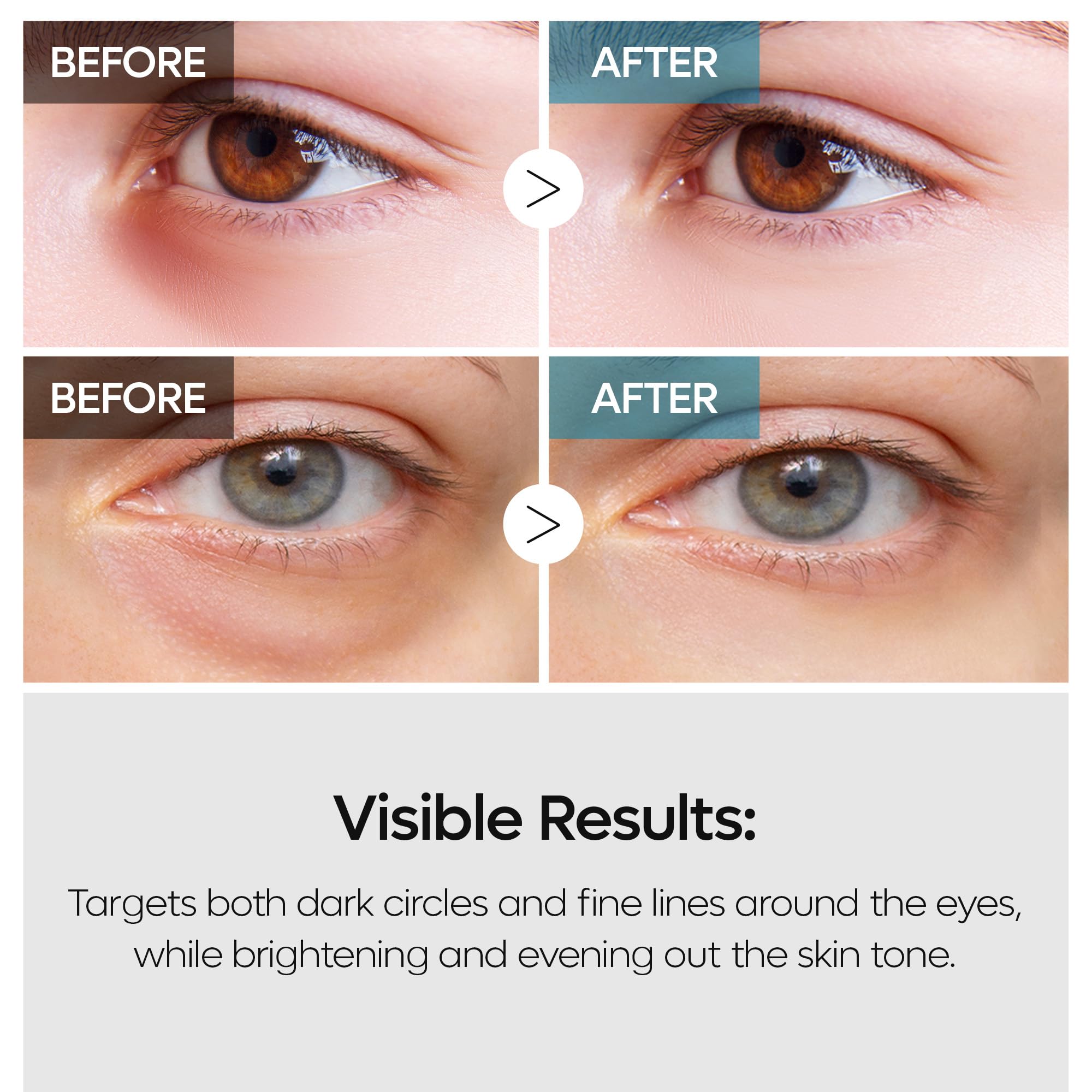 Dr.Melaxin TX Dual Eye Cream with Tranexamic Acid, Adenosine & Niacinamide | Dark Circle Repair | 50ml