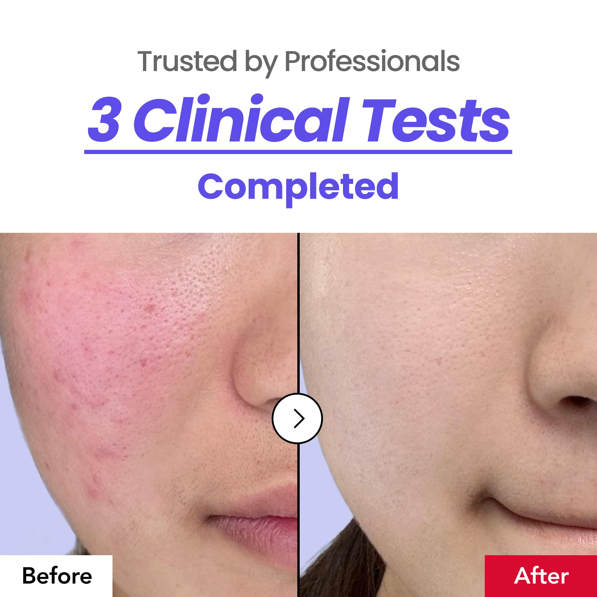 dr.percent Calming 64% Cream – Instant Soothing, Redness Relief, Hydration (30ml)