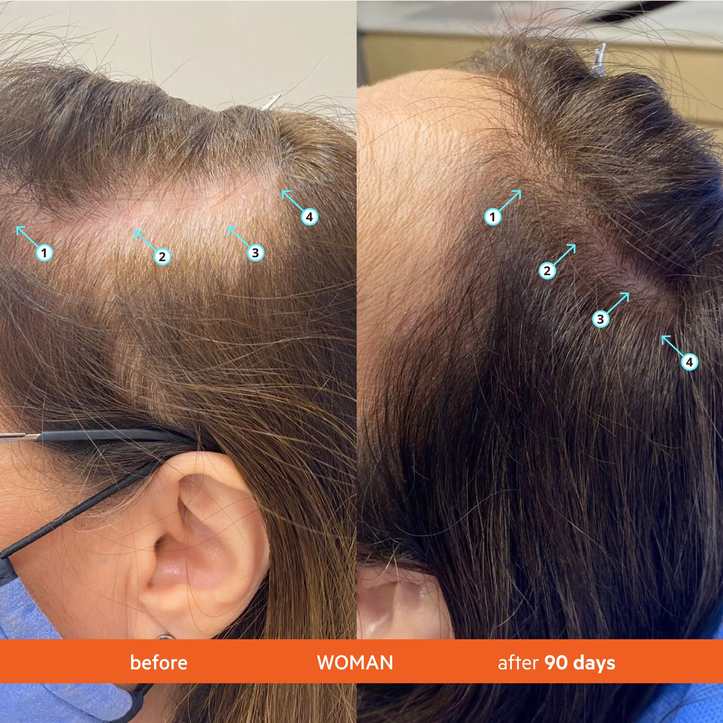 DS Labs Revita Conditioner – Scalp Refreshing Hydration, Fuller-Looking Hair, Color Safe