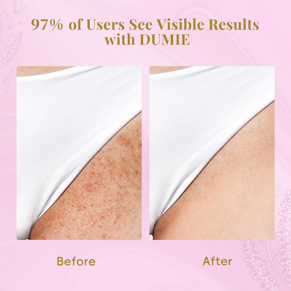 Dumie Cyperus Rotundus Serum Roll-On – Ingrown Hair & Razor Bump Care (60ml)