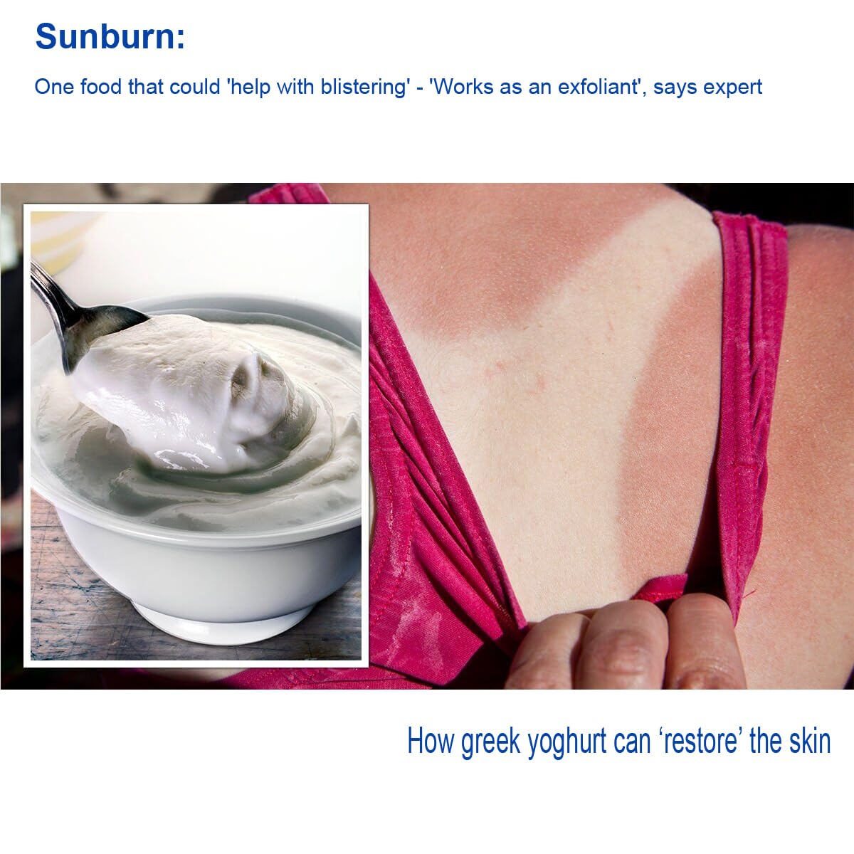 DurbaLife Sunburn Relief Bundle: Aloe First 16.9 oz + Cooling After Sun Gel (20 ml)