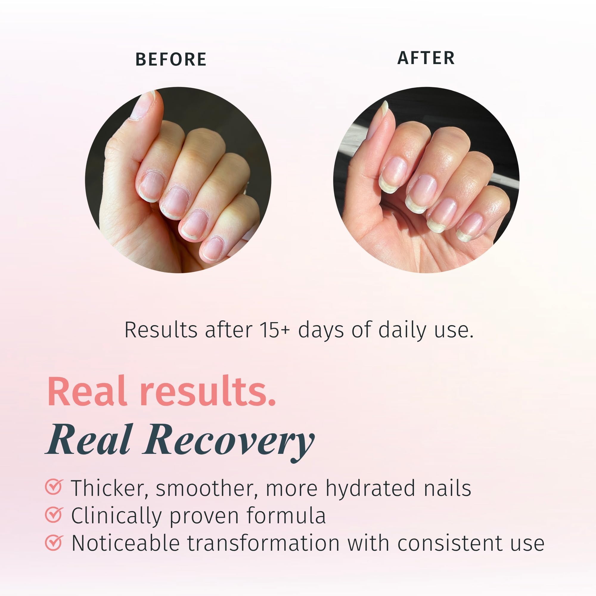 Duri Rejuvacote 1 Nail Strengthener – Maximum Effect Formula (Pack of 3 x 0.45 fl oz)