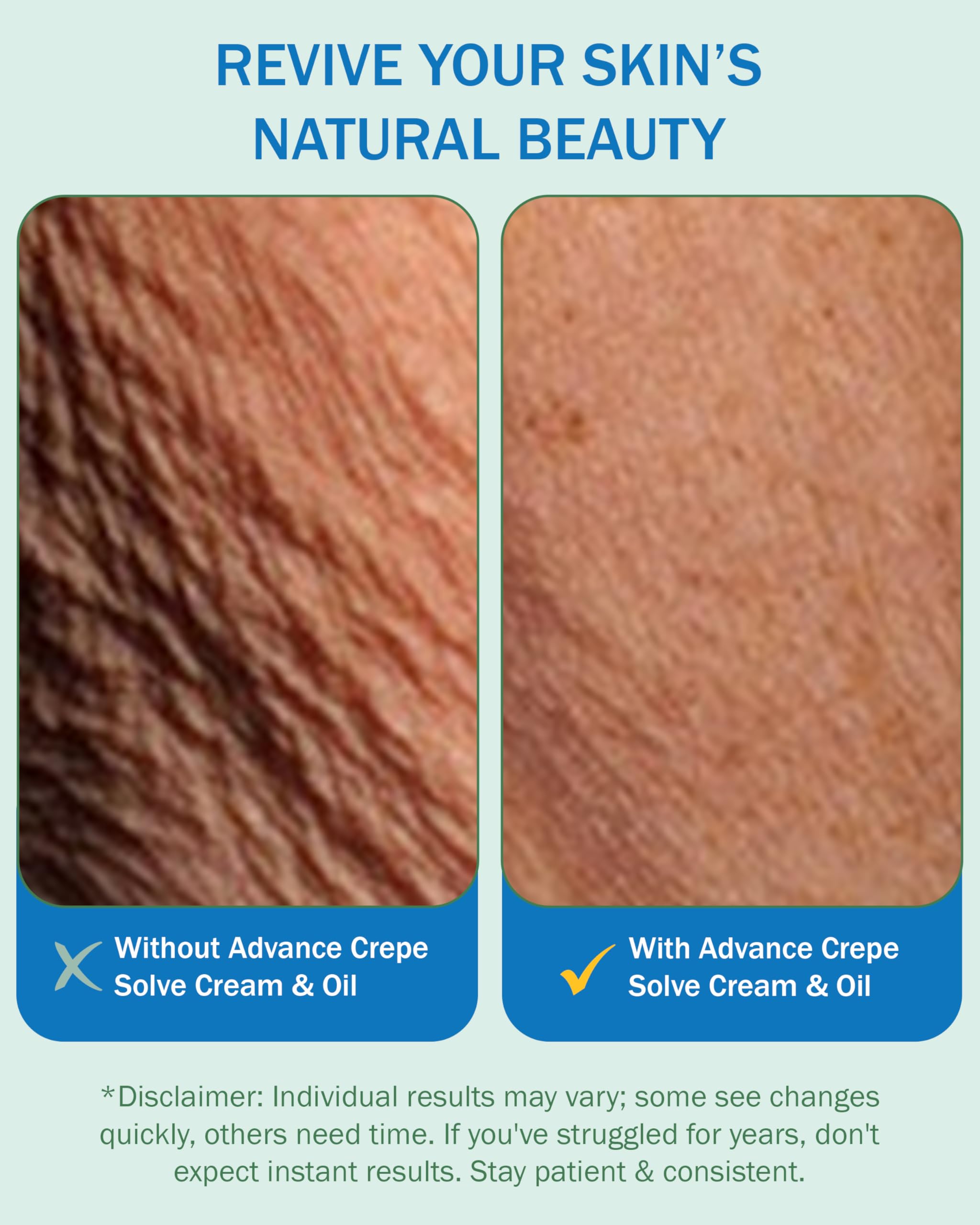 e70 Crepe Skin Erase Cream & Firming Oil Set (2 Pk, 4 Fl Oz Each) - Made in USA