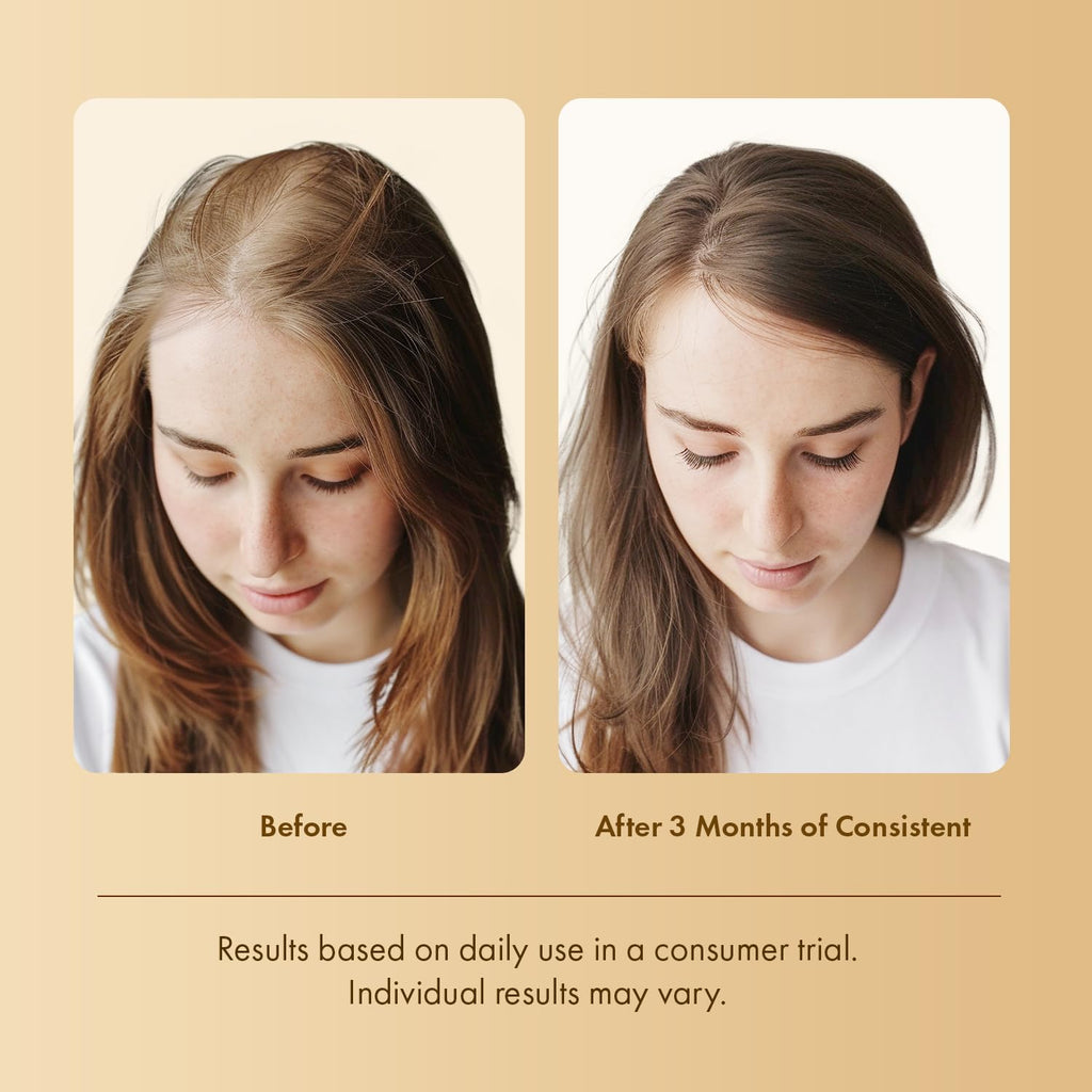 EarthShine Hair Growth Serum – Rosemary, Peptides & Caffeine