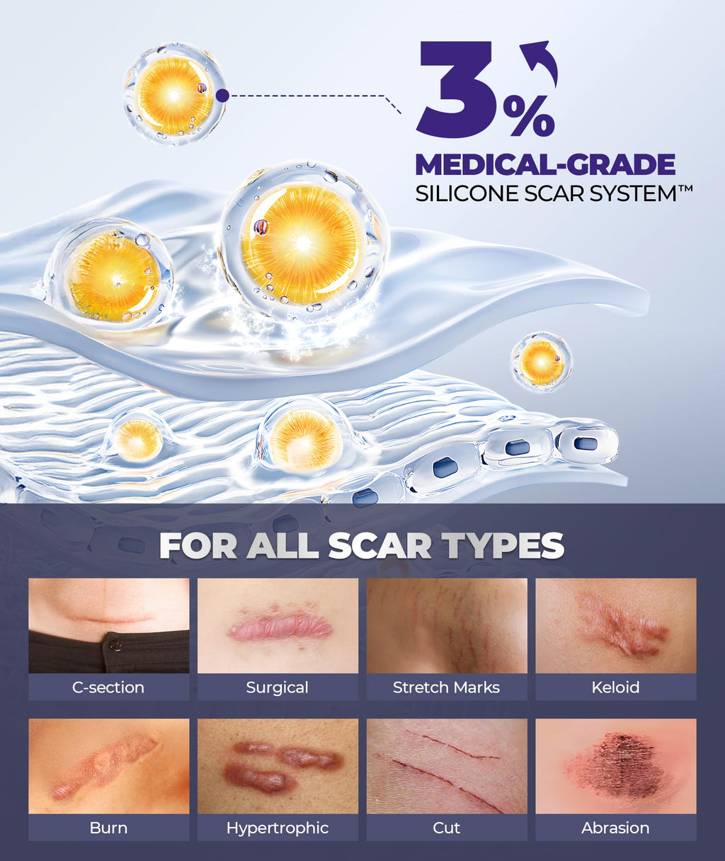 EaseWave Silicone Scar Cream – 6.7% Active, Visible in 2 Weeks, 55ml, For Surgical, C-Section, Acne, Burn Scars and Stretch Marks