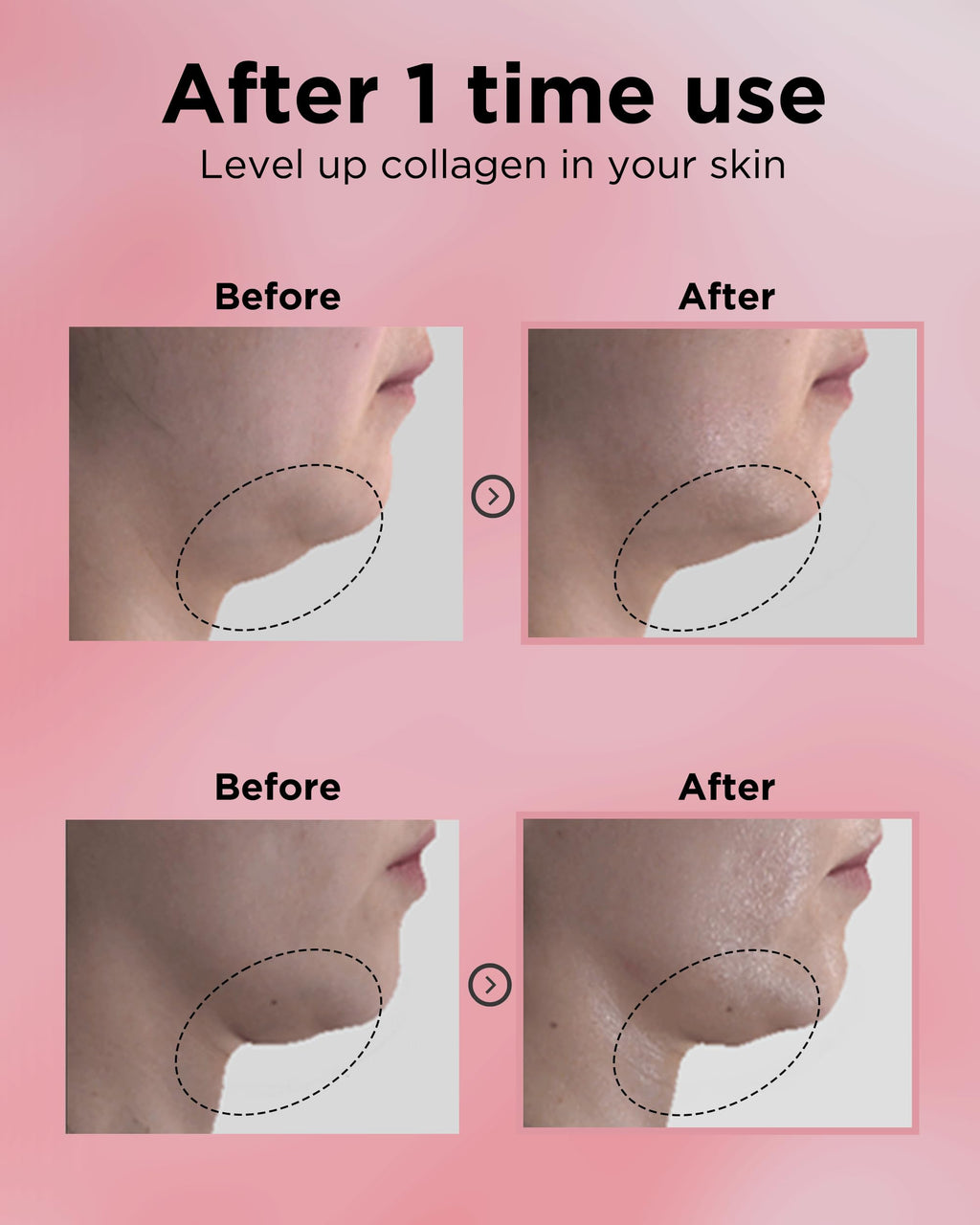 EASYDEW DW-EGF 55% Collagen Silkream Ampoule – Firmness & Elasticity Serum (1.86oz)
