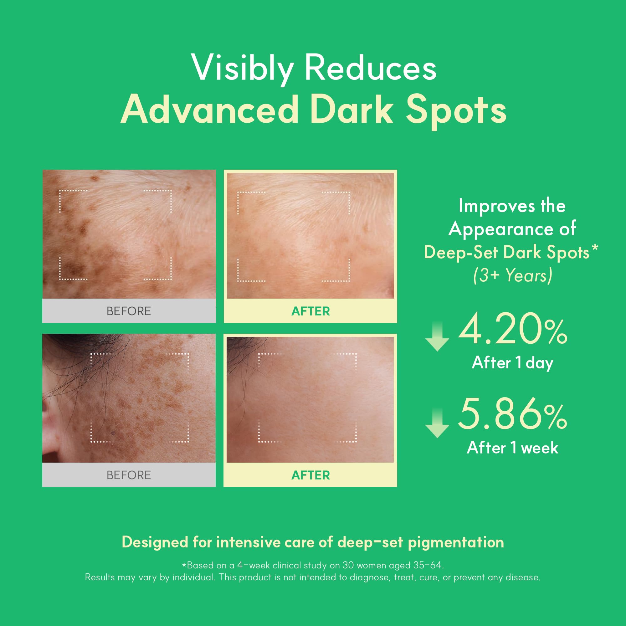 Easydew DW-EGF Melatoning Ampoule 5X – Hydrating Dark Spot Serum with Niacinamide & Glutathione | Day & Night, Fast-Absorbing