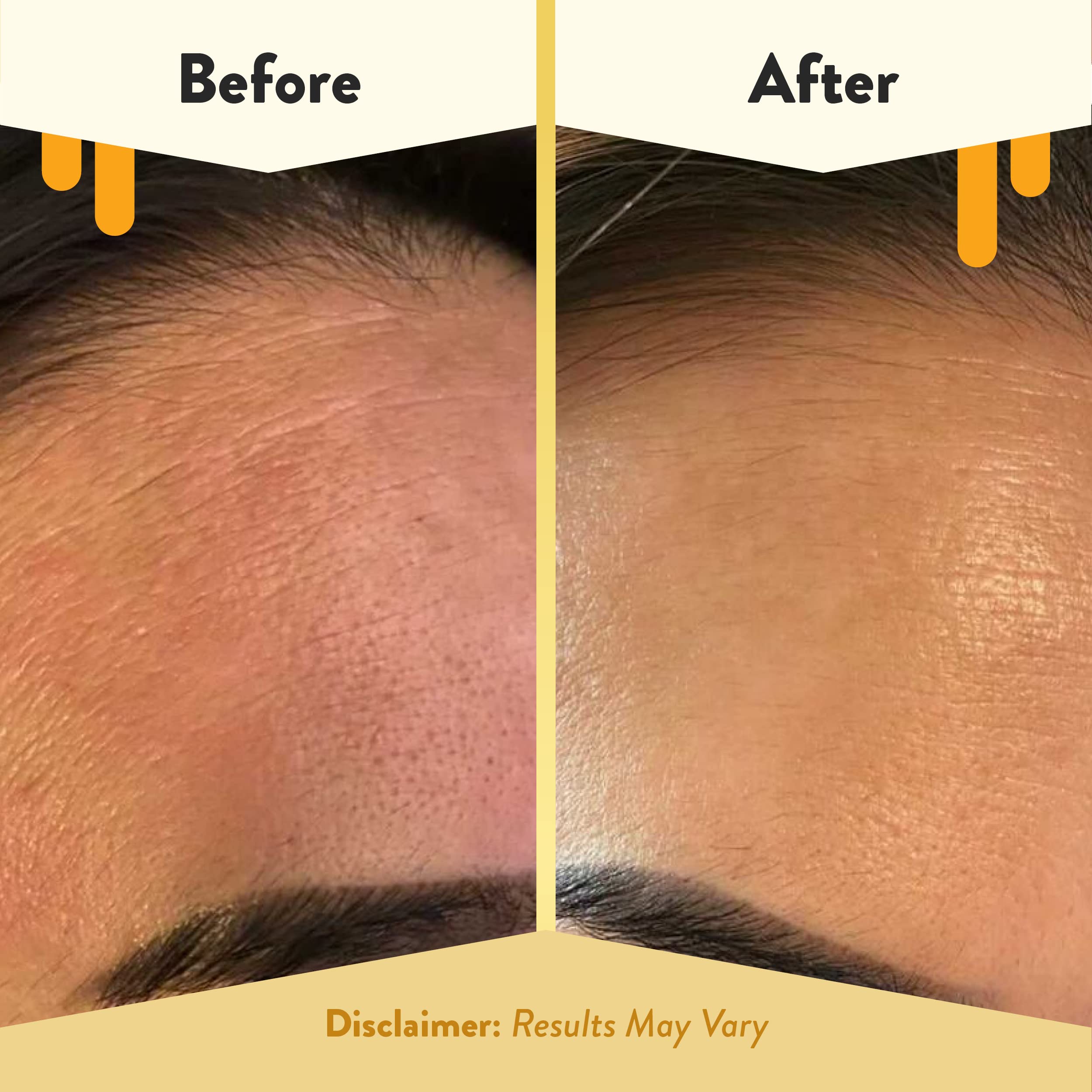 ECZEMA HONEY Oatmeal Facial Cleanser – Gentle Daily Face Wash for Dry, Itchy & Sensitive Skin | 6 oz