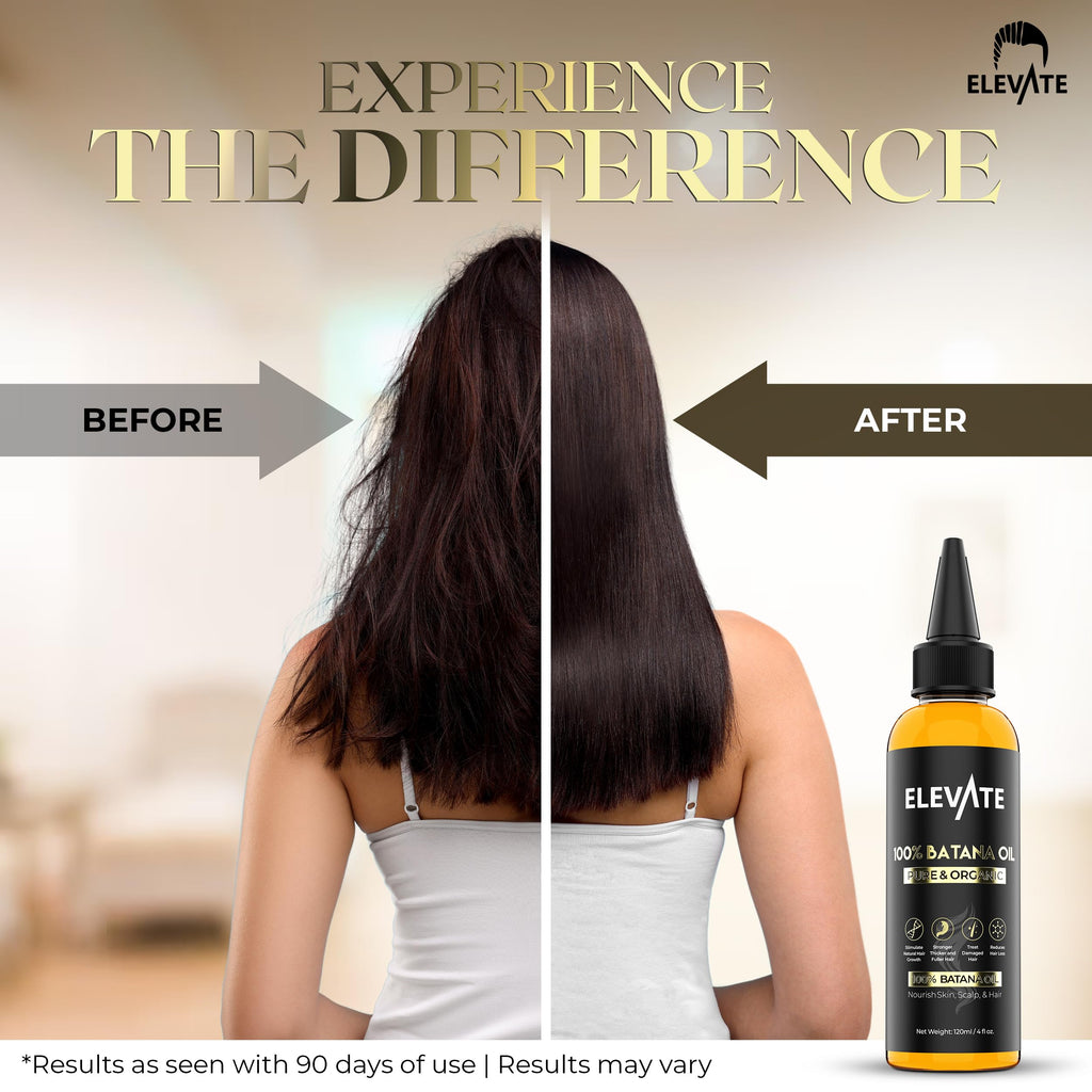 Elevate Batana Oil for Hair Growth – 100% Pure, Cold-Pressed Honduran Oil | 4 Fl Oz