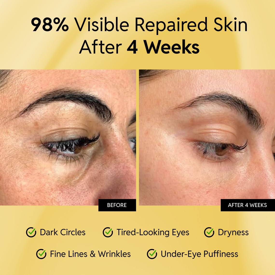 Eliré Korean Repair Eye Cream – Ceramide-Rich, Caffeine-Boost Under-Eye Treatment (15ml)