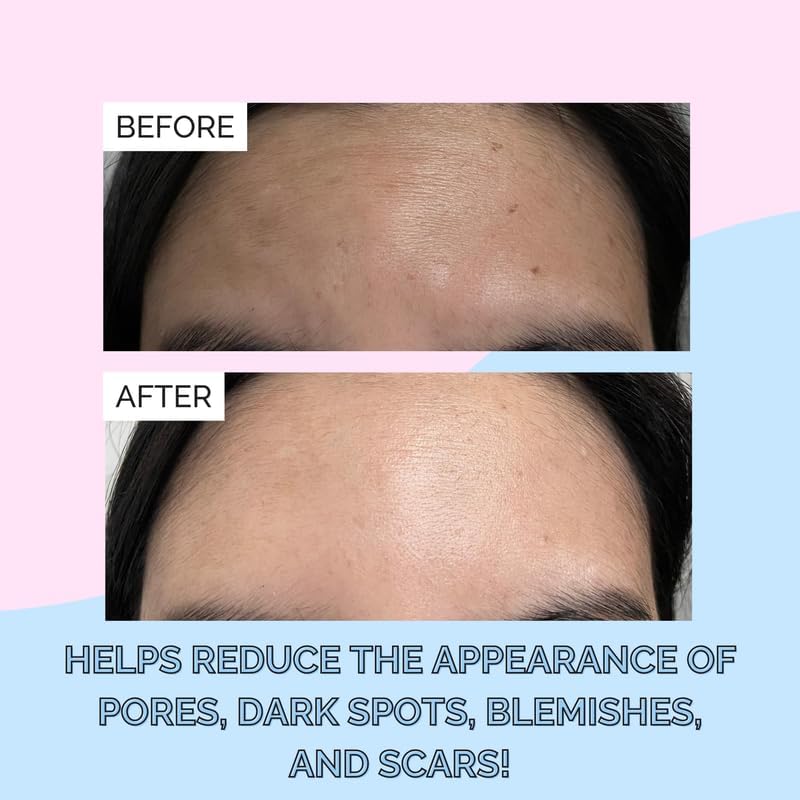 Elizabeth Mott Korean Snail Mucin Serum — 97% Snail Filtrate, Deep Hydration, Glass Skin (100 mL)