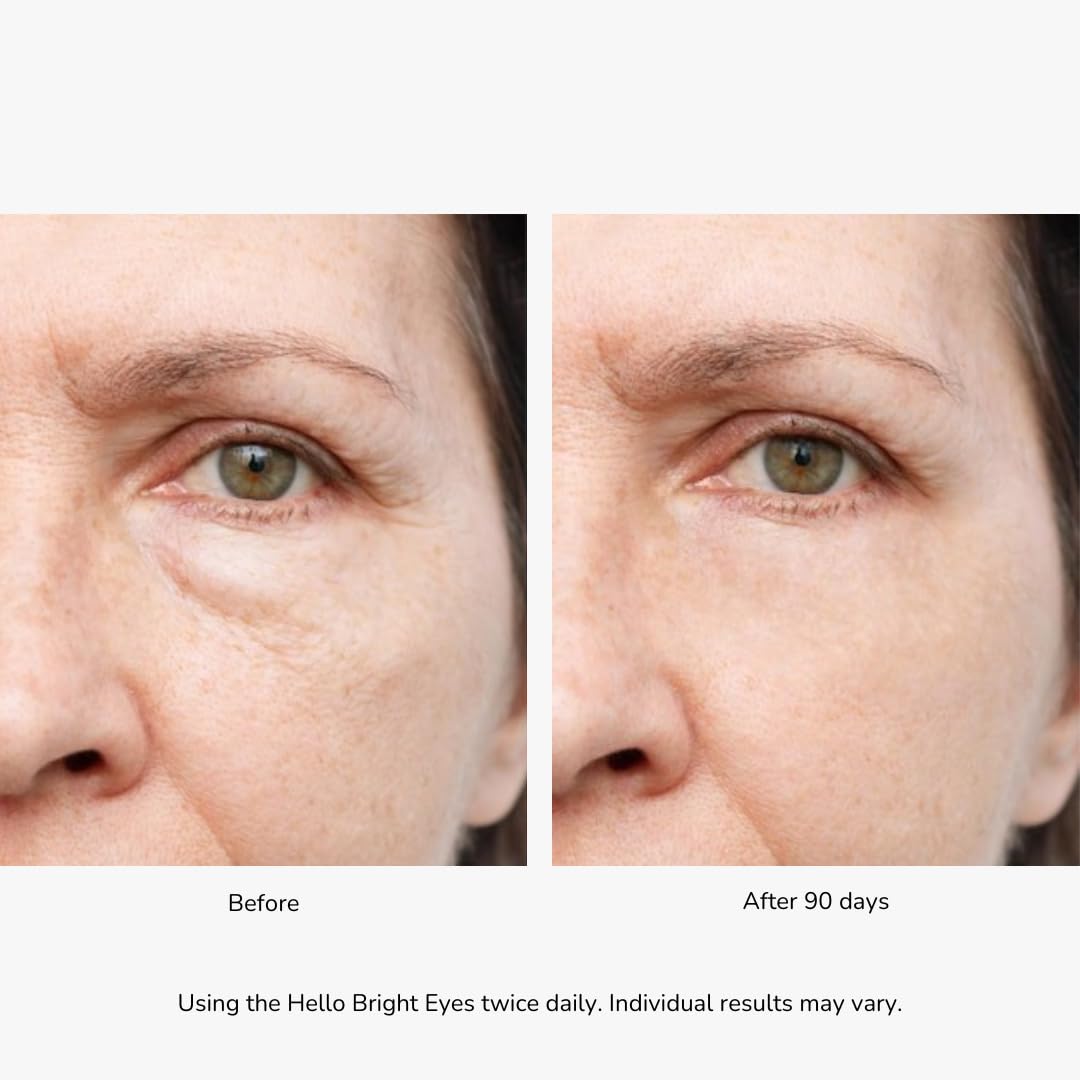 Emani Hello Bright Eyes Vitamin C Eye Cream with Caffeine & Turmeric