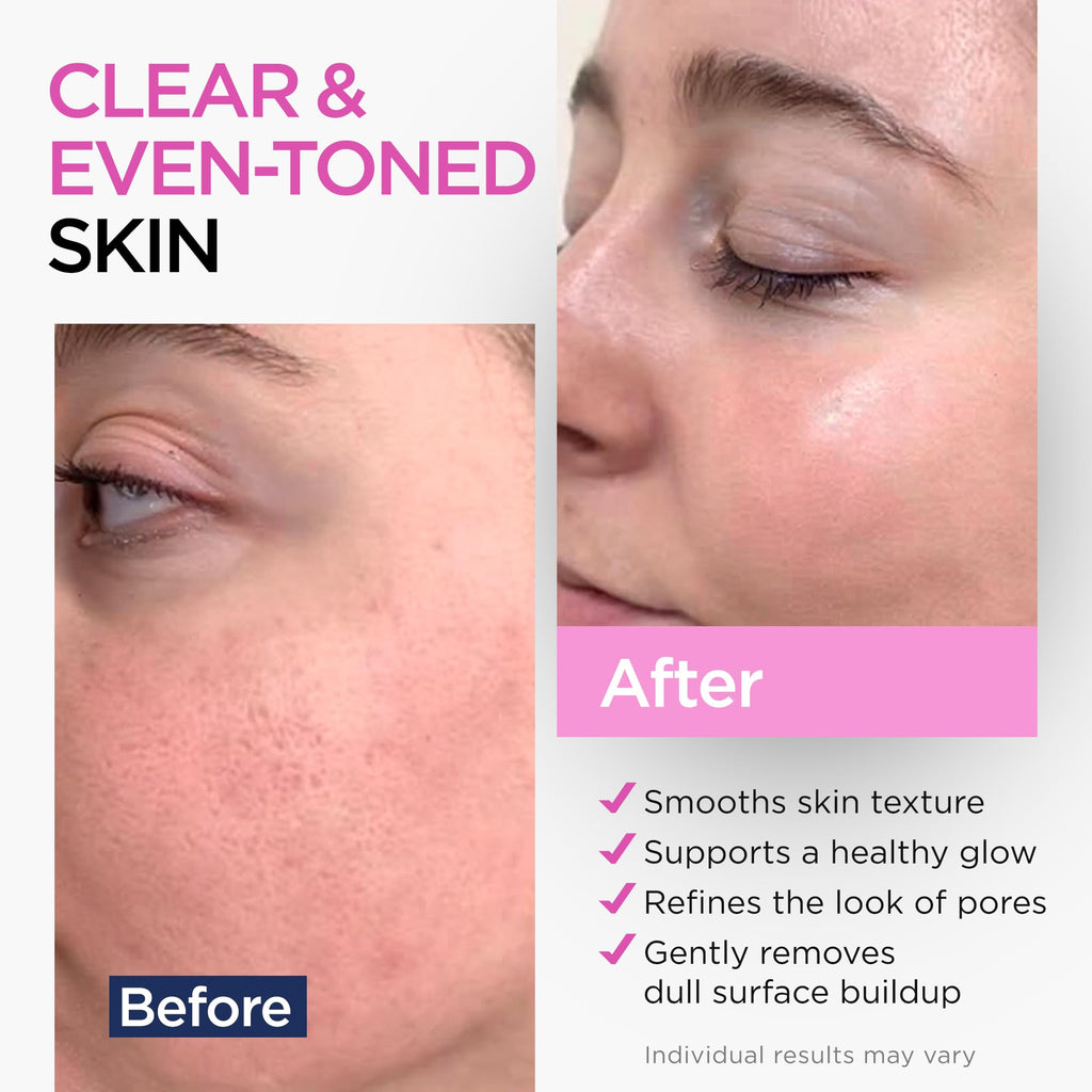 Ember Cloud Glycolic Acid Serum 15% – Extra Large 2 oz for Radiance & Even Tone
