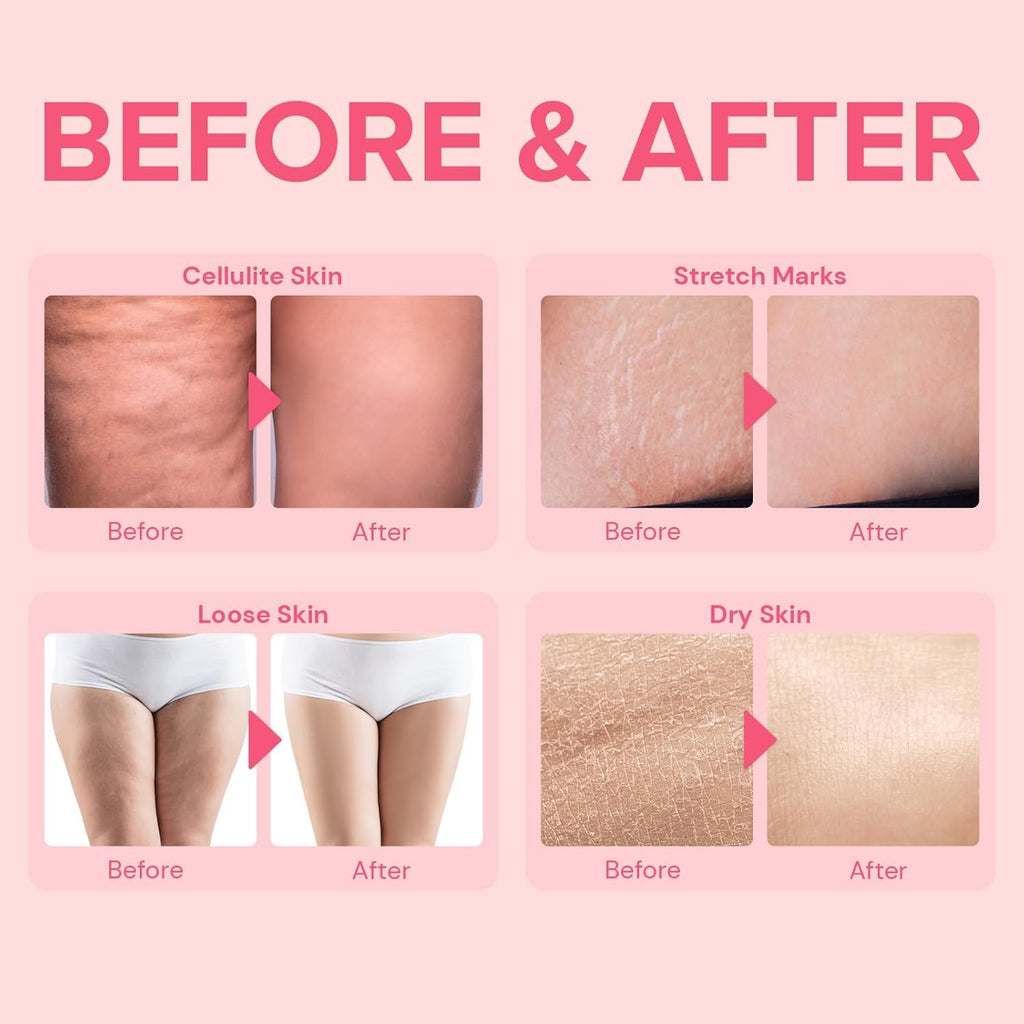 Enaskin Naturals Anti-Cellulite Cream | Body Firming Lotion for Legs, Thighs & Belly | 100 ml