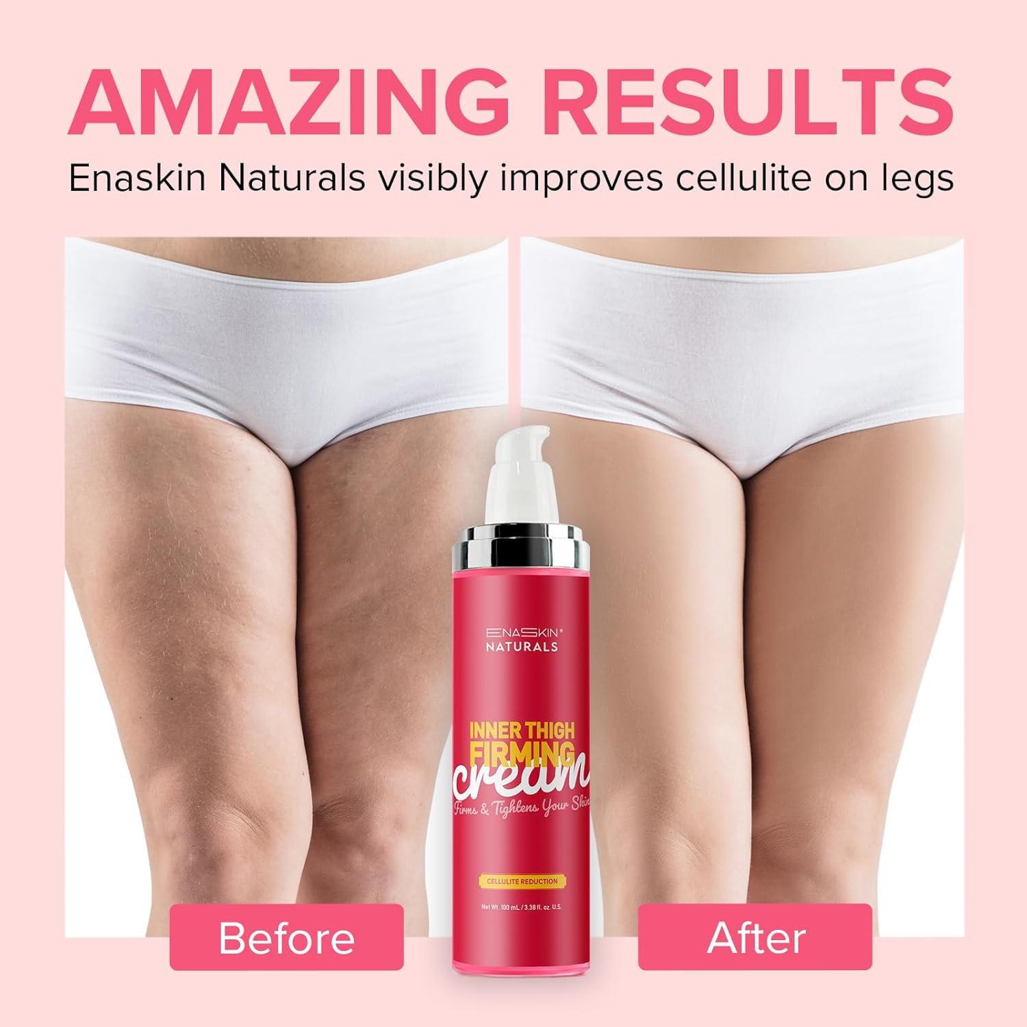 Enaskin Naturals Anti-Cellulite Cream | Body Firming Lotion for Legs, Thighs & Belly | 100 ml