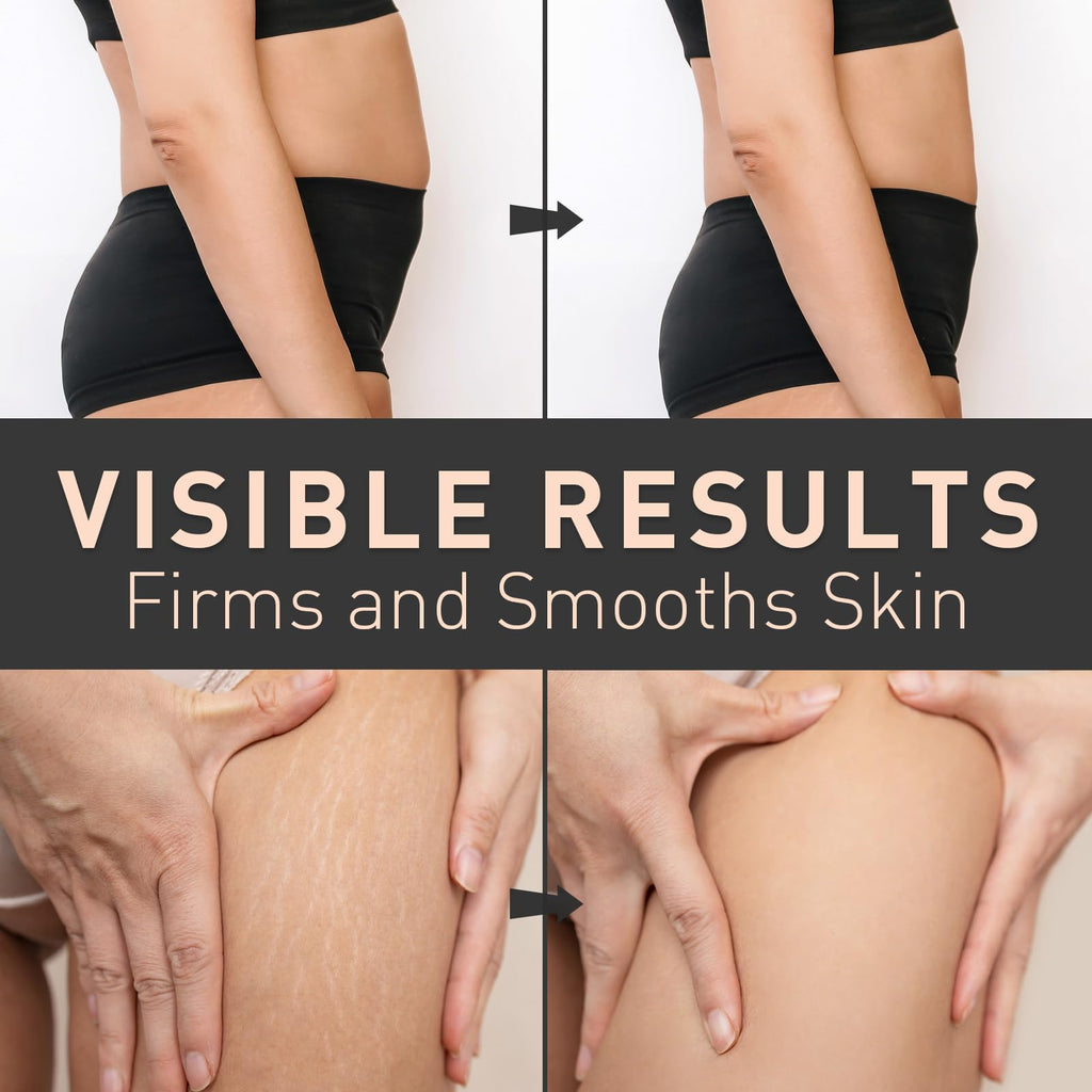 Enaskin Naturals Belly Firming Cream – Skin Tightening, Stretch Marks & Cellulite Reduction (100 mL, Orange)