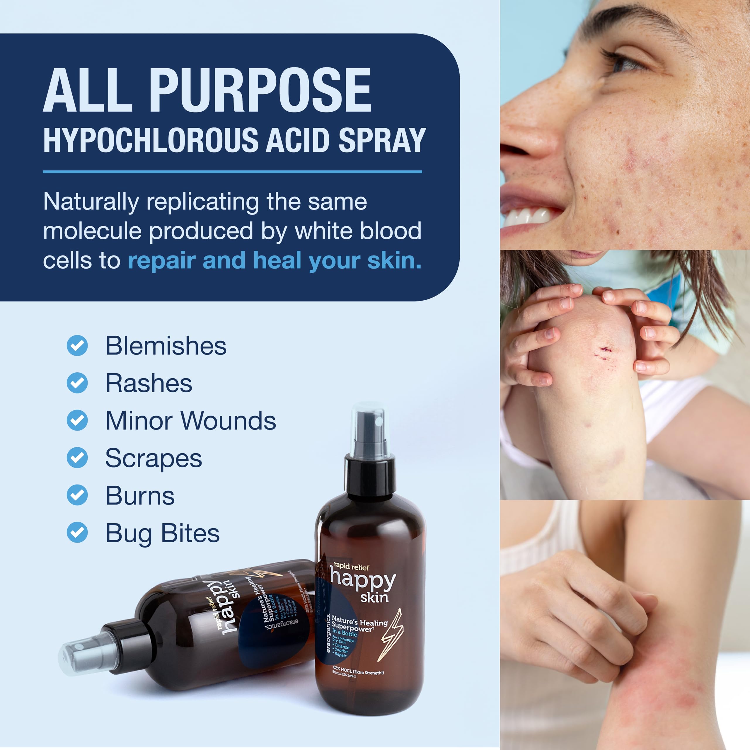Era Organics Happy Skin HOCl Spray – Extra Strength Gentle Face Cleanser for Acne, Dry & Sensitive Skin | 4 oz
