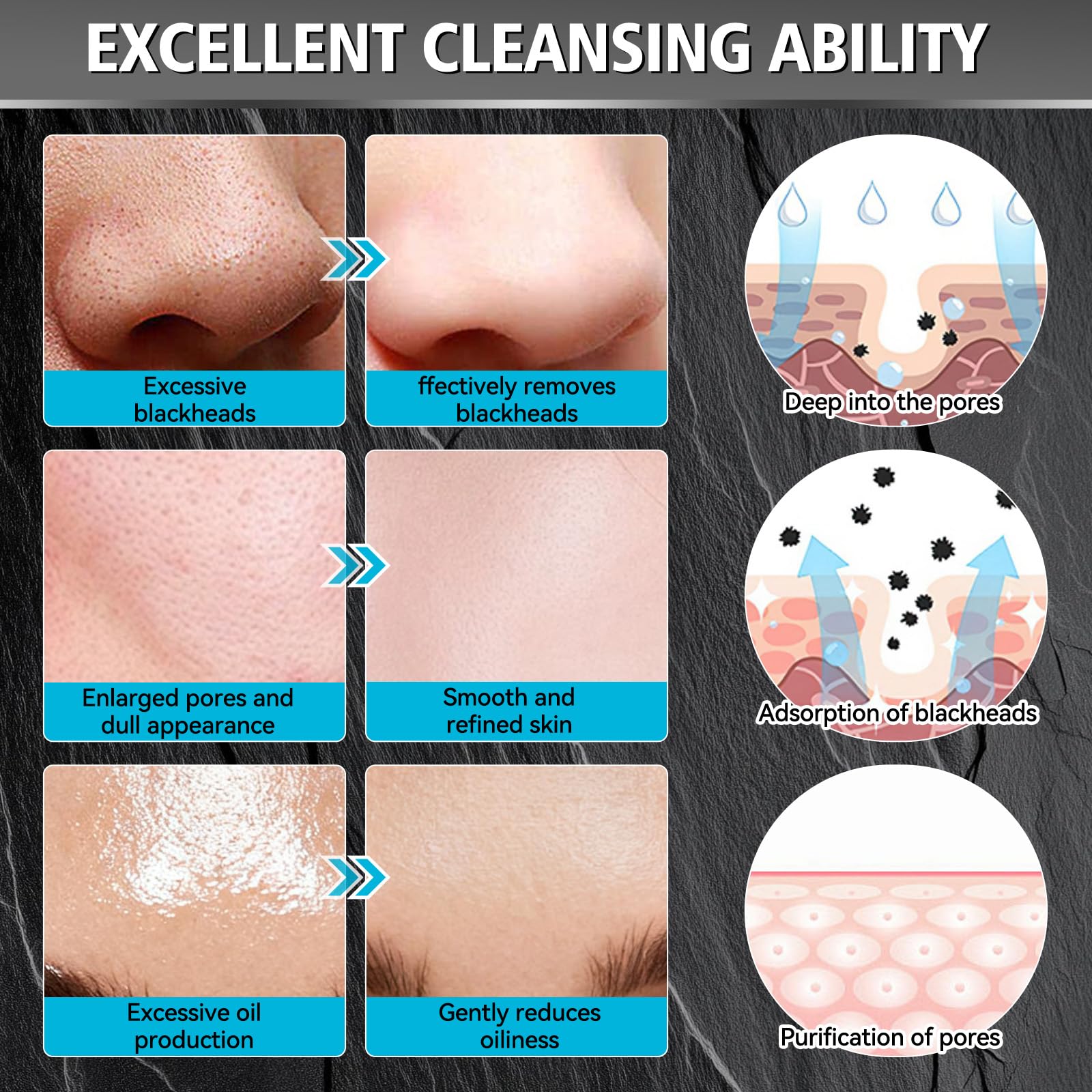 Erigathe Charcoal Peel Off Mask - Deep Cleansing Blackhead Remover for Face & Nose | 4.23 oz